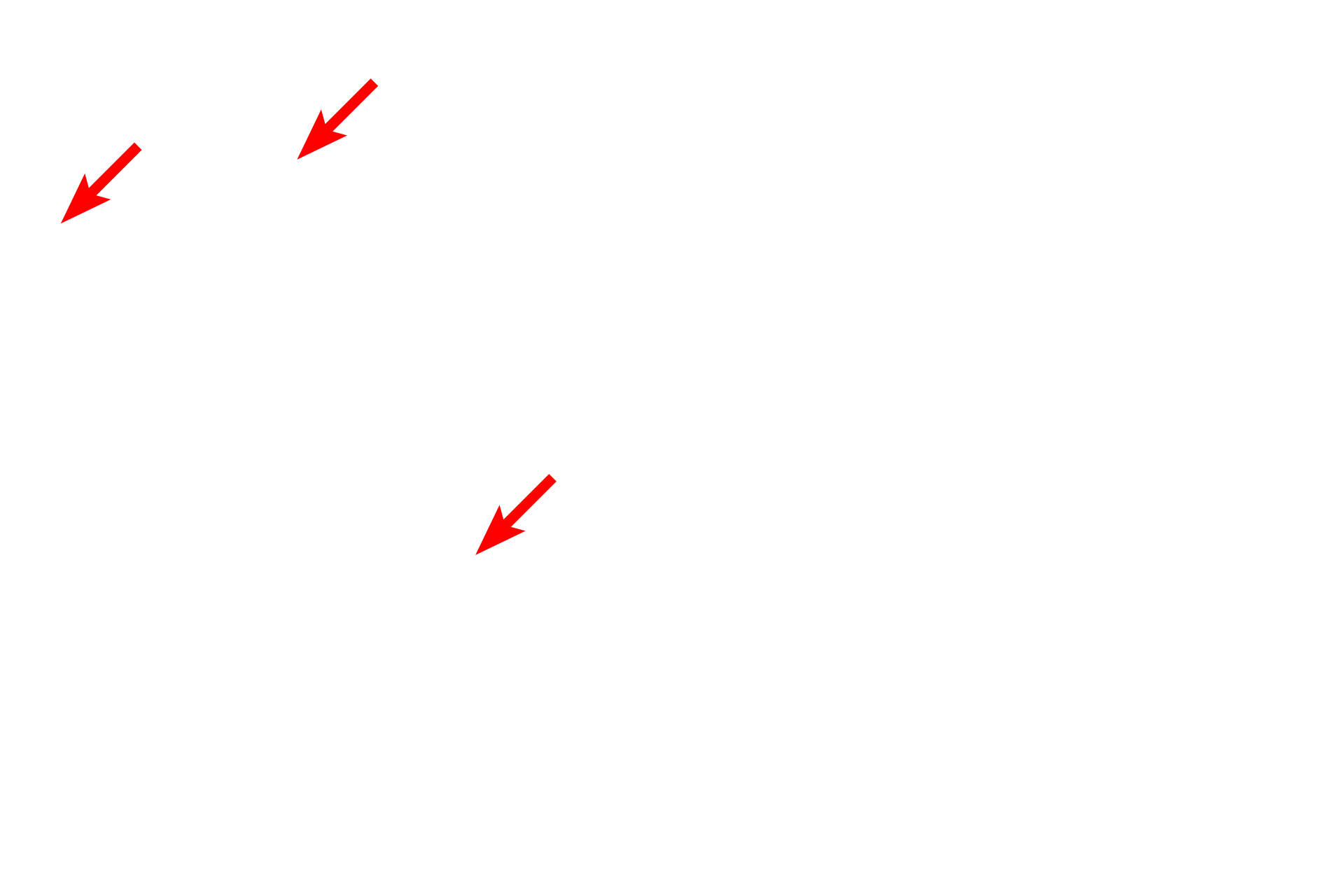  - Stria <p>The junction of the enamel (left) and dentin (right) is shown in this section of ground tooth.  The dentin is formed and maintained throughout life by odontoblasts that lie in the pulp cavity adjacent to the dentin.  Odontoblasts secrete matrix, investing their processes in dentinal tubules which span the thickness of the dentin.  200x</p>
