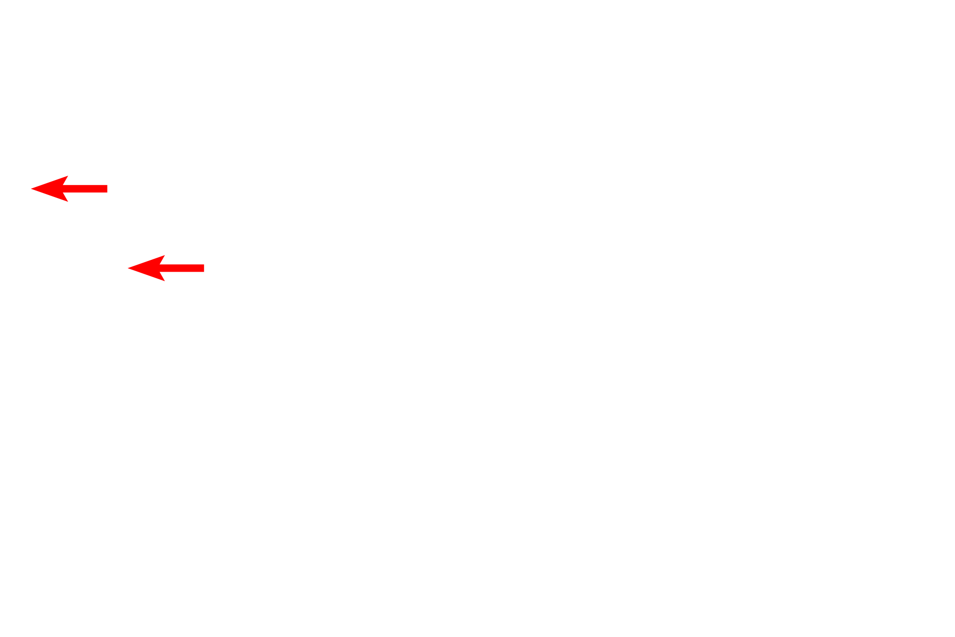  - Stria <p>A section of ground tooth shows the dentin and the dentinal tubules.  Dentin is the most similar to bone of all the hard tissues of the tooth.  The dentinal tubules, housing odontoblast processes, form S-shaped curves and extend from the pulp chamber, where the odontoblasts are located, to the dentino-enamel or the dentino-cementum junctions.  200x</p>
