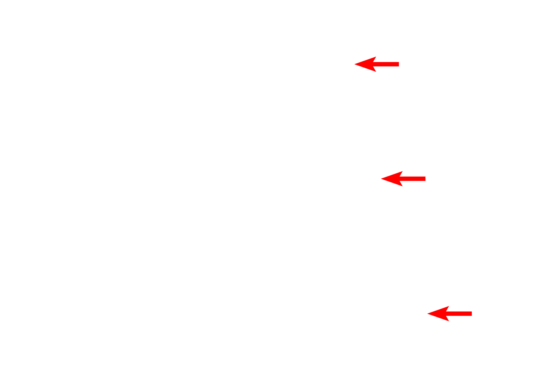  - Acellular cementum <p>This ground tooth shows cementum, the outermost covering of the root. A thin layer of cementum begins at the cementoenamel junction and continues to the apex of the tooth, thickening as it does so. Cementum contains cementocytes, resembling osteocytes. The periodontal ligament (not present in this image) extends from cementum to adjacent alveolar bone. 10x, 200x</p>
