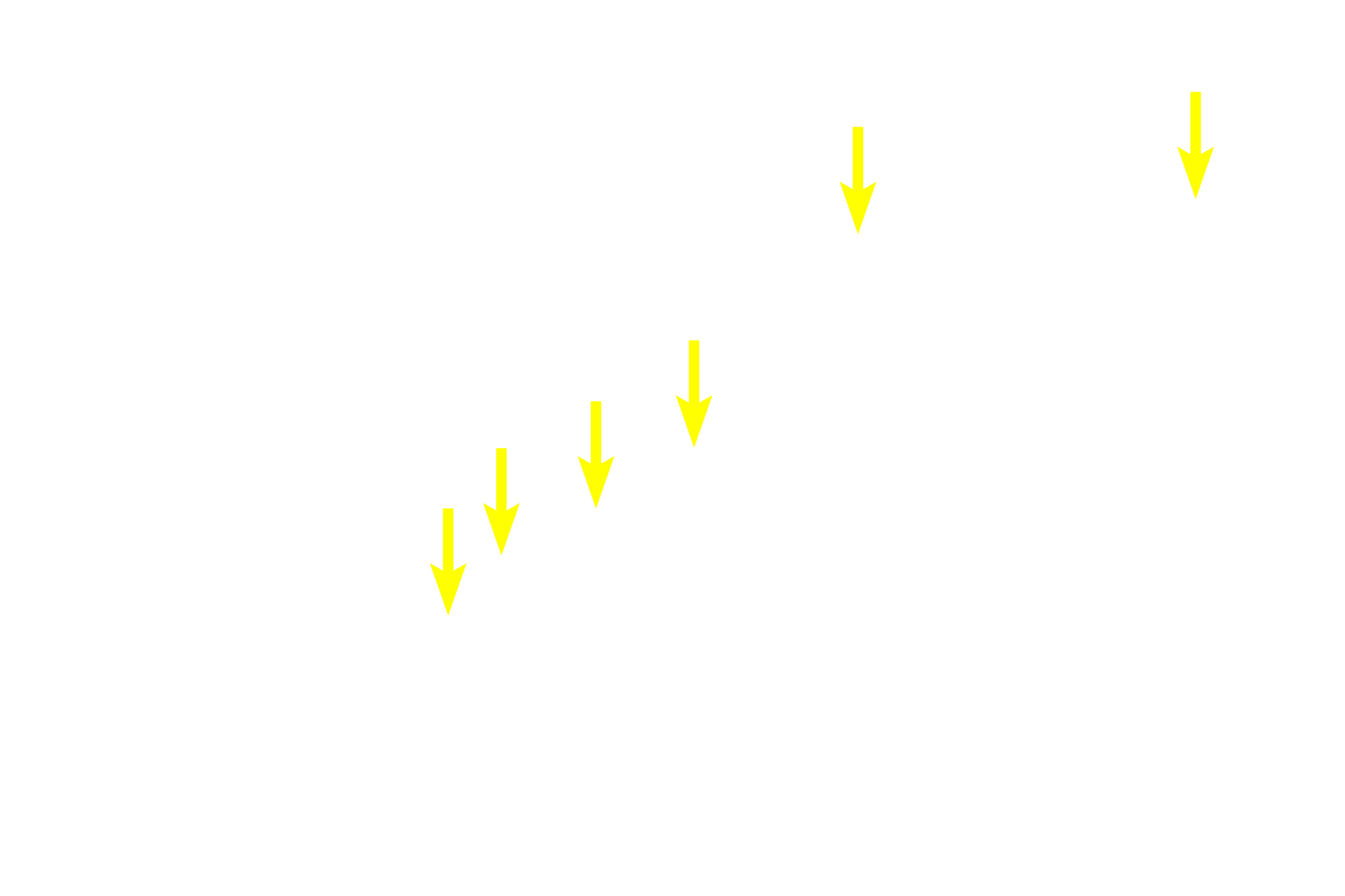  - Ciliary epithelium: pigmented layer <p>The ciliary epithelium is a portion of the non-sensory retinal layer of the inner tunic.  This layer lines the posterior surface of the ciliary body and its processes, before continuing over the posterior surface of the iris.  Ciliary epithelium consists of two epithelial layers, with the one adjacent to the stroma being heavily pigmented.  The ciliary epithelium produces the zonule fibers and secretes aqueous humor.</p>
