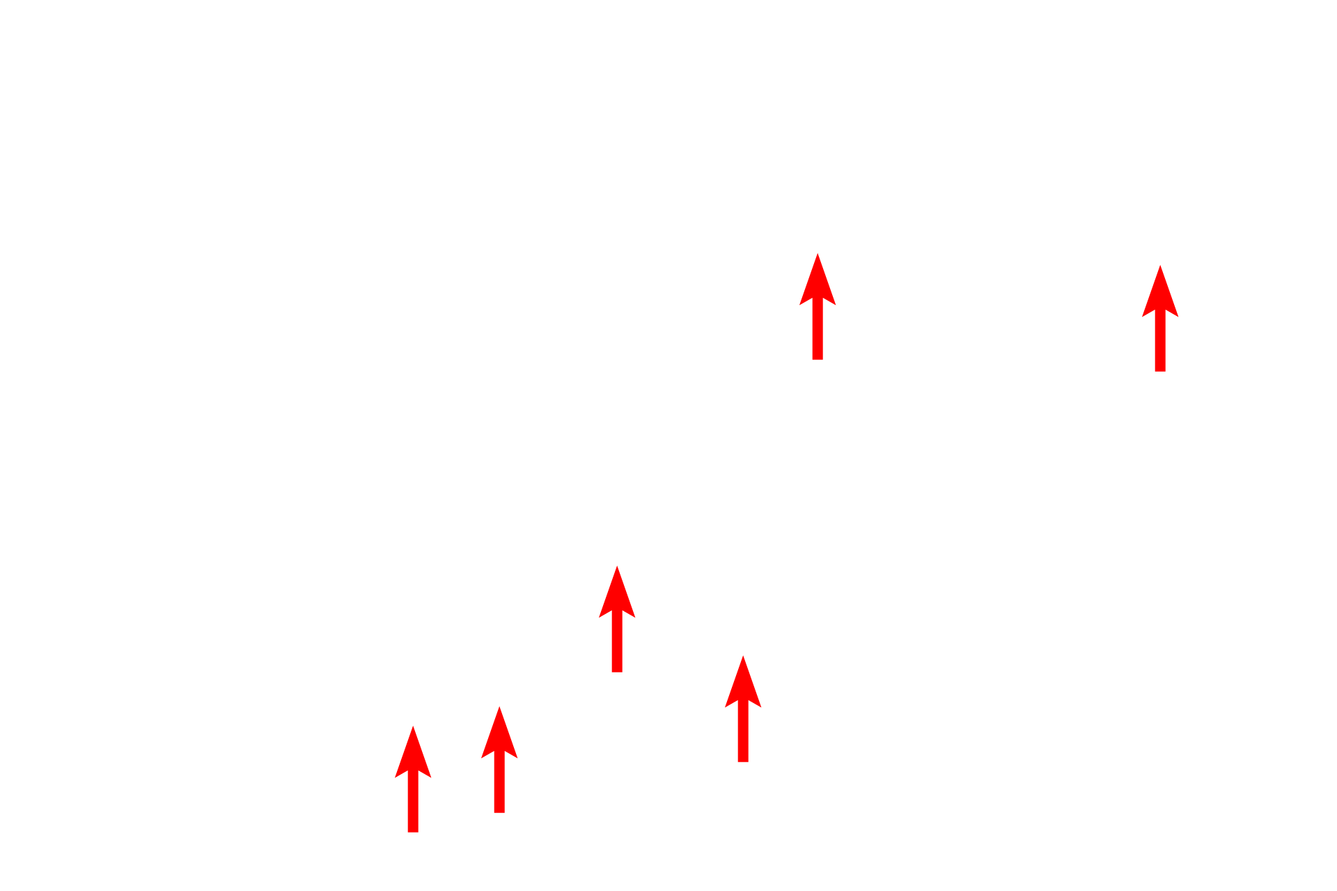  - Ciliary epithelium: non-pigmented layer <p>The ciliary epithelium is a portion of the non-sensory retinal layer of the inner tunic.  This layer lines the posterior surface of the ciliary body and its processes, before continuing over the posterior surface of the iris.  Ciliary epithelium consists of two epithelial layers, with the one adjacent to the stroma being heavily pigmented.  The ciliary epithelium produces the zonule fibers and secretes aqueous humor.</p>
