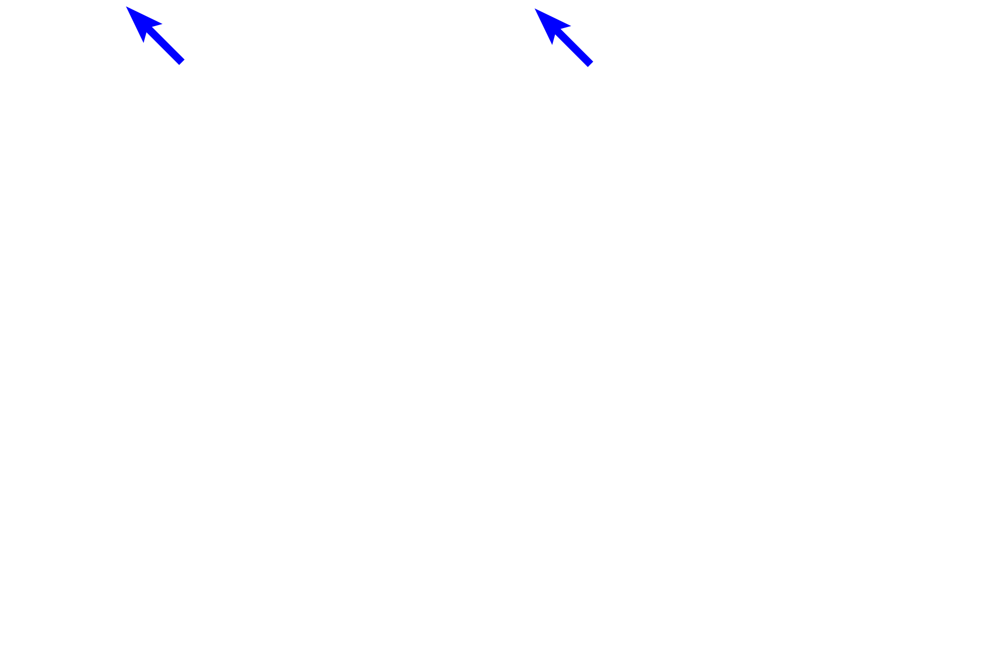 Vitreous chamber <p>The retina, innermost tunic and light sensing part of the eye, is embryologically a part of the central nervous system, as is the optic nerve that connects the retina to the brain.  The sensory retina consists of a multilayered, photosensitive, neural retina and its underlying, non-visual pigment epithelium, which absorbs light, thus reducing glare.  800x</p>

