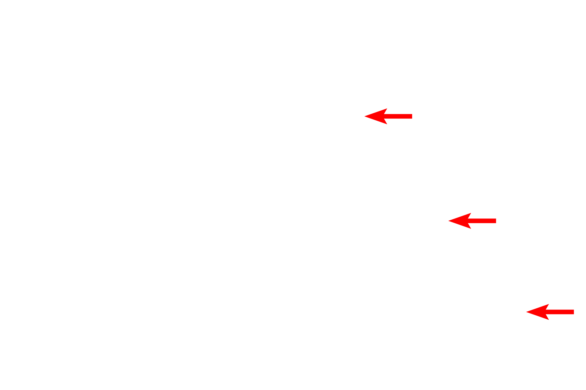  - Pigmented layer <p>The non-photosensitive, anterior portion of the retina is reduced in thickness and number of layers from the photosensitive portion. This non-visual retina forms the posterior lining of both the ciliary body and the iris.</p>
