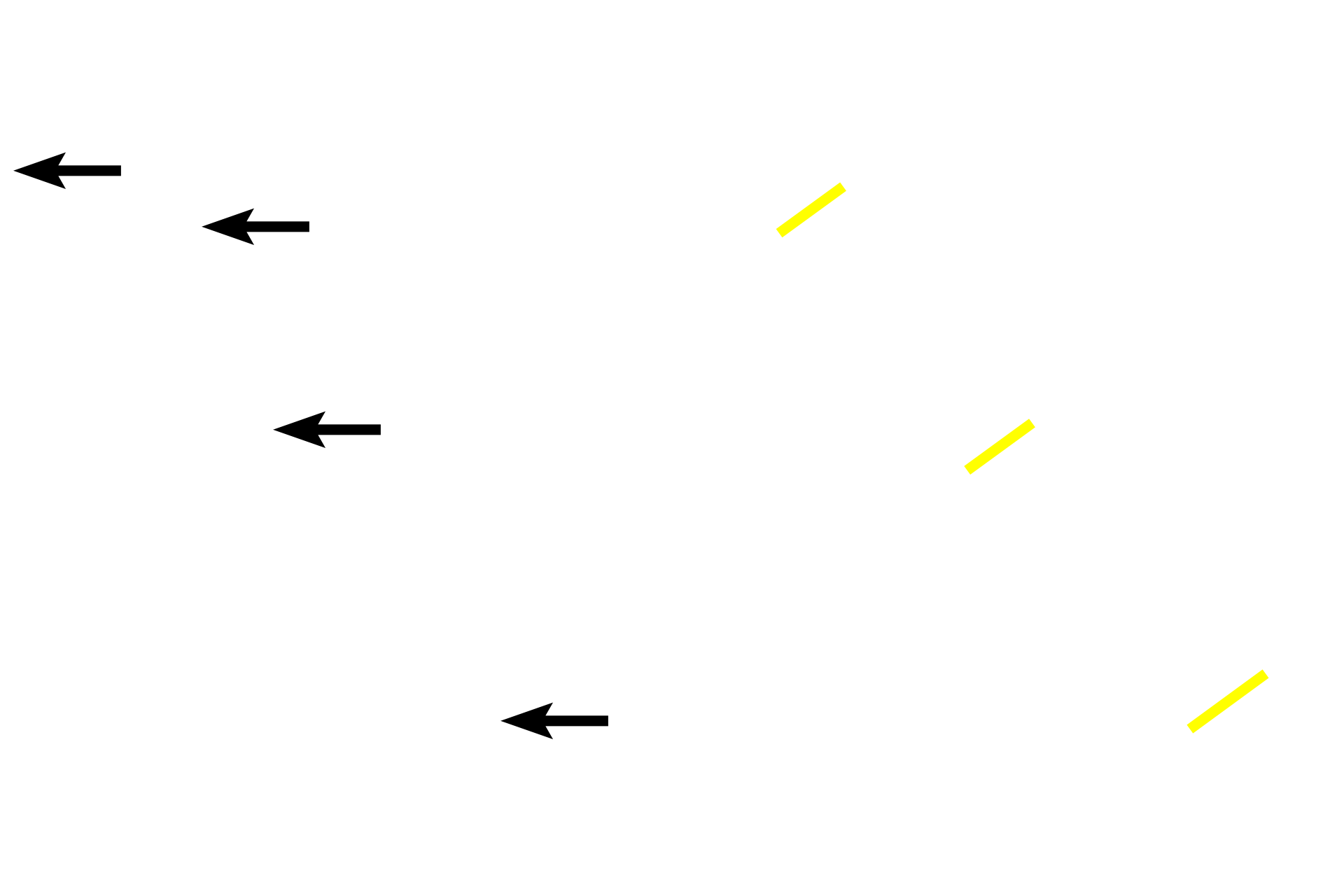 Non-sensory retina > <p>The non-photosensitive, anterior portion of the retina is reduced in thickness and number of layers from the photosensitive portion. This non-visual retina forms the posterior lining of both the ciliary body and the iris.</p>
