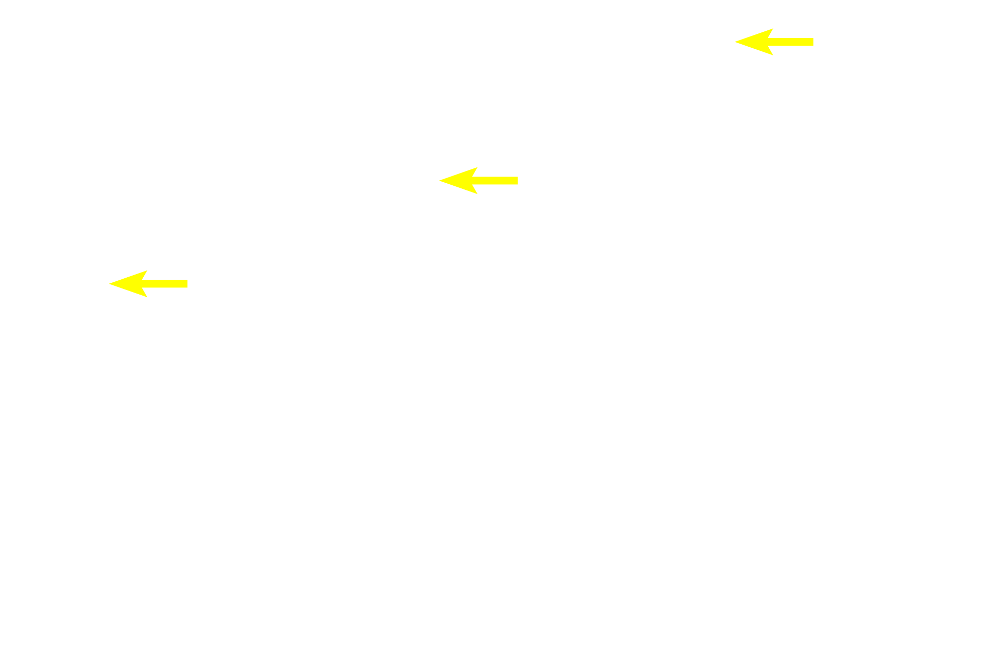  - Inner plexiform layer > <p>The inner plexiform layer is the location of synapses of bipolar cells and ganglion cells.</p>

