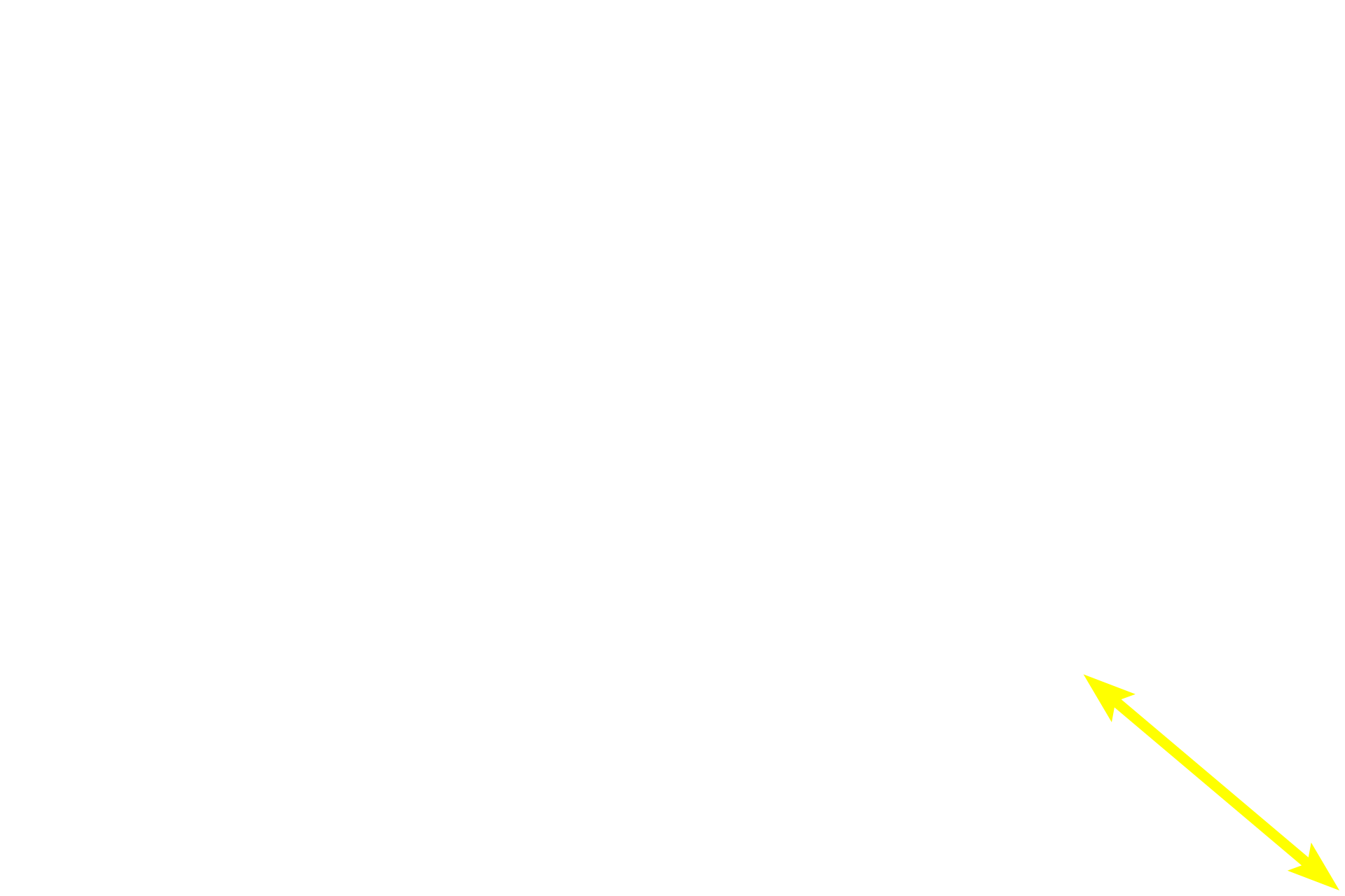 Choroid > <p>The choroid is visible in the lower right.  The choroid layer, which is pigmented and highly vascular, forms part of the vascular tunic, along with the ciliary body and the iris.</p>
