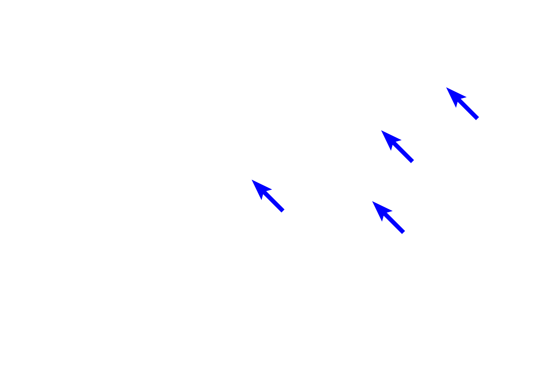 Apocrine sweat glands <p>The anus is seen in the right half of this image. It is lined by a stratified squamous, keratinized epithelium and possesses apocrine sweat glands, eccrine sweat glands, sebaceous glands and hair follicles.  Apocrine sweat glands are characterized by their large size, tubular structure and wide lumens.  Also visible are the internal and external anal sphincters. 40x</p>
