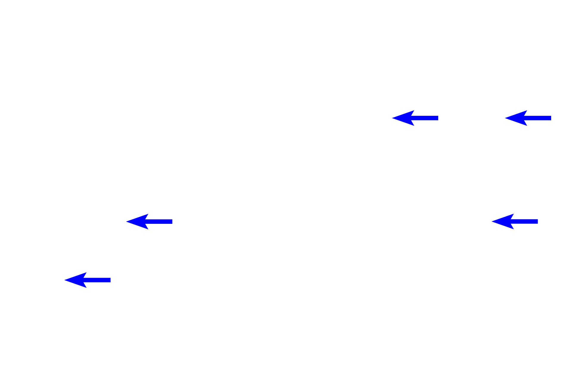  - Capillaries <p>These images show two special histochemical stains used to distinguish among the different cell types in the islet of Langerhans.  The aldehyde fuchsin method (left) stains insulin-secreting beta cells blue.  The Gomori’s method (right) stains insulin-secreting beta cells light blue and glucagon-secreting alpha cells pink.  Beta cells comprise about 70% of the islet cells, alpha cells about 20%.  The remaining somtatostatin-secreting delta cells are not distinguished by these methods. 400x, 400x</p>
