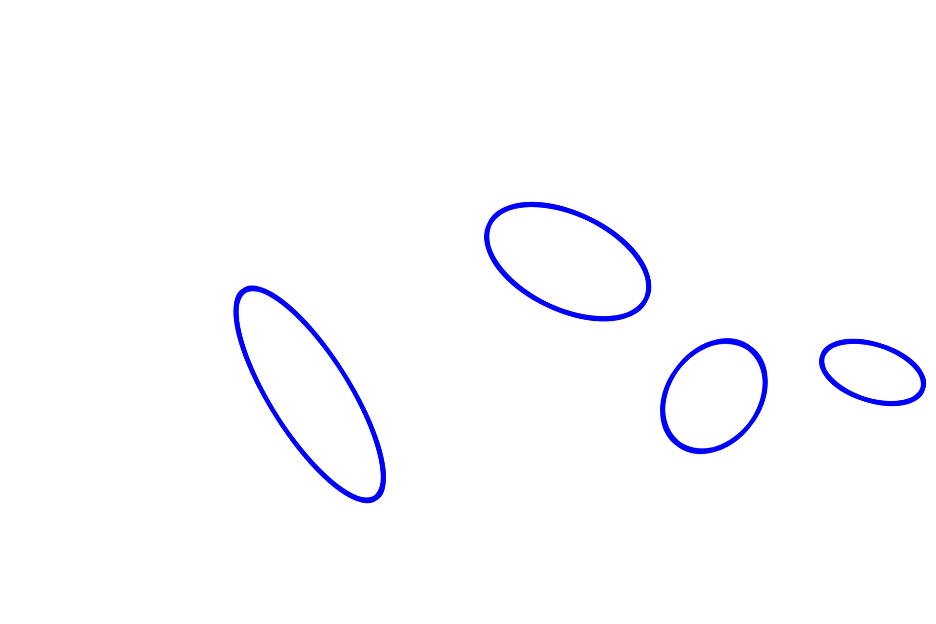 Apocrine sweat glands <p>The anus is lined by a stratified squamous, keratinized epithelium and possesses apocrine sweat glands, eccrine sweat glands, sebaceous glands and hair follicles.  Both apocrine sweat glands and sebaceous glands release their products into a hair follicle.  Apocrine sweat glands are characterized by their large size and wide lumens and, like eccrine sweat glands, are classified as simple coiled tubular glands.  100x</p>
