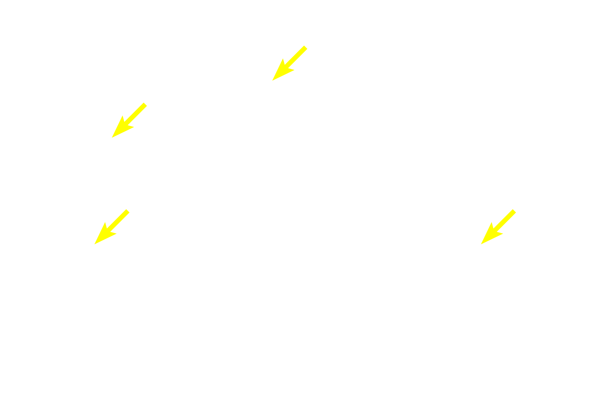 Principal cells <p>The parathyroids consist of two pairs of glands embedded in the posterior surface of the thyroid gland.  Like most endocrine glands, the parenchymal cells of the parathyroid are arranged in plates with large numbers of intervening fenestrated capillaries.  Two cell types are present, chief or principal cells and oxyphils. Principal cells predominate and secrete parathyroid hormone, which raises blood calcium levels.  Parathyroid hormone secretion is regulated by blood calcium levels.  The function of oxyphil cells, the minor cell type, is unclear.  100x</p>
