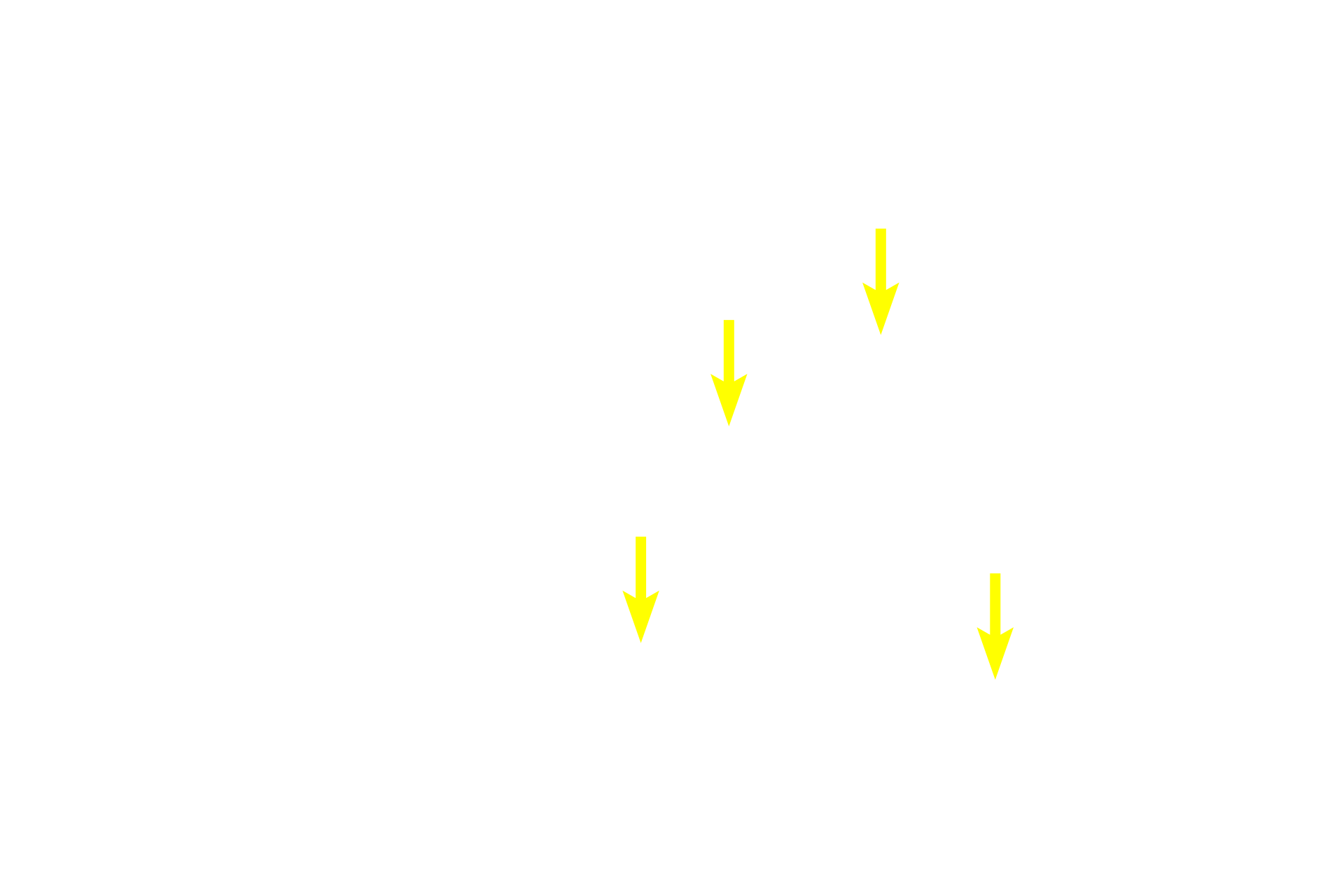 Oxyphil cells <p>The parathyroids consist of two pairs of glands embedded in the posterior surface of the thyroid gland.  Like most endocrine glands, the parenchymal cells of the parathyroid are arranged in plates with large numbers of intervening fenestrated capillaries.  Two cell types are present, chief or principal cells and oxyphils. Principal cells predominate and secrete parathyroid hormone, which raises blood calcium levels.  Parathyroid hormone secretion is regulated by blood calcium levels.  The function of oxyphil cells, the minor cell type, is unclear.  100x</p>
