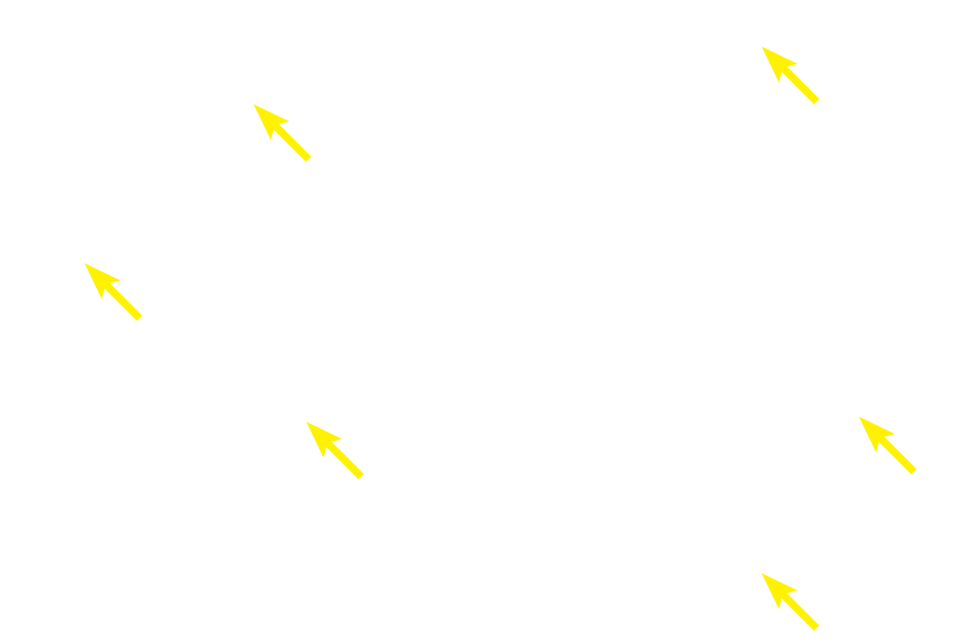 Principal cells <p>The special stain used in these images clearly reveals the distribution of oxyphil cells among the more numerous principal cells. Principal cells have sparse amounts of cytoplasm and heterochromatic nuclei.  Oxyphil cells have more abundant cytoplasm, which stains reddish due to presence of large numbers of mitochondria.  400x, 1000x</p>
