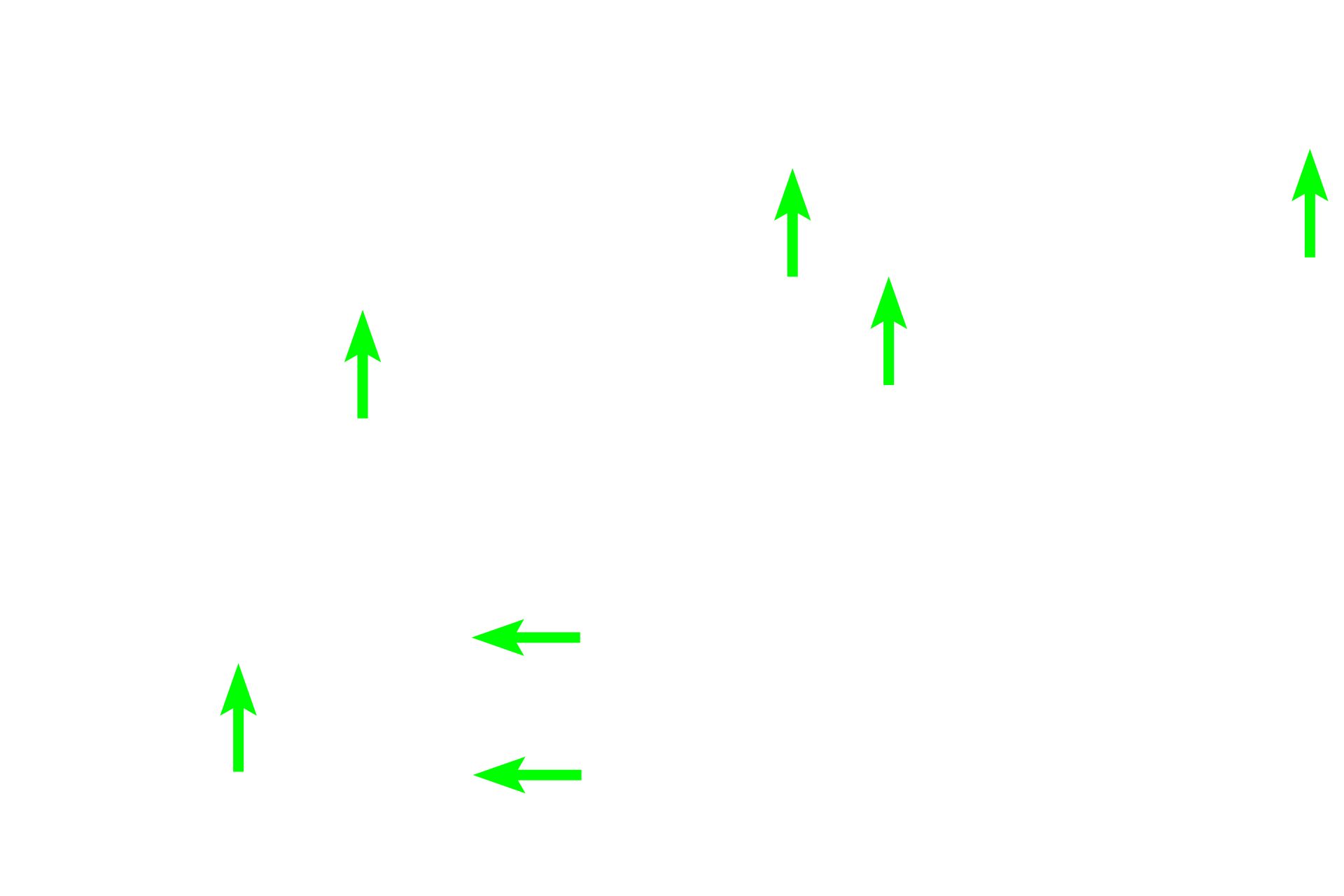 Capillaries <p>The special stain used in these images clearly reveals the distribution of oxyphil cells among the more numerous principal cells. Principal cells have sparse amounts of cytoplasm and heterochromatic nuclei.  Oxyphil cells have more abundant cytoplasm, which stains reddish due to presence of large numbers of mitochondria.  400x, 1000x</p>
