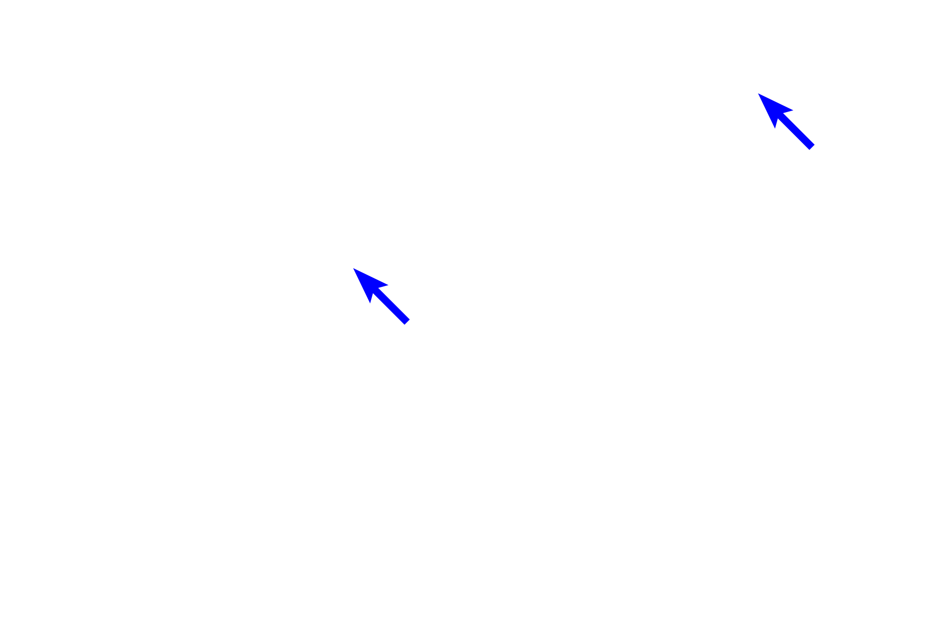 Sebaceous glands <p>The anus is seen in the right half of this image. It is lined by a stratified squamous, keratinized epithelium and possesses apocrine sweat glands, eccrine sweat glands, sebaceous glands and hair follicles.  Apocrine sweat glands are characterized by their large size, tubular structure and wide lumens.  Also visible are the internal and external anal sphincters. 40x</p>
