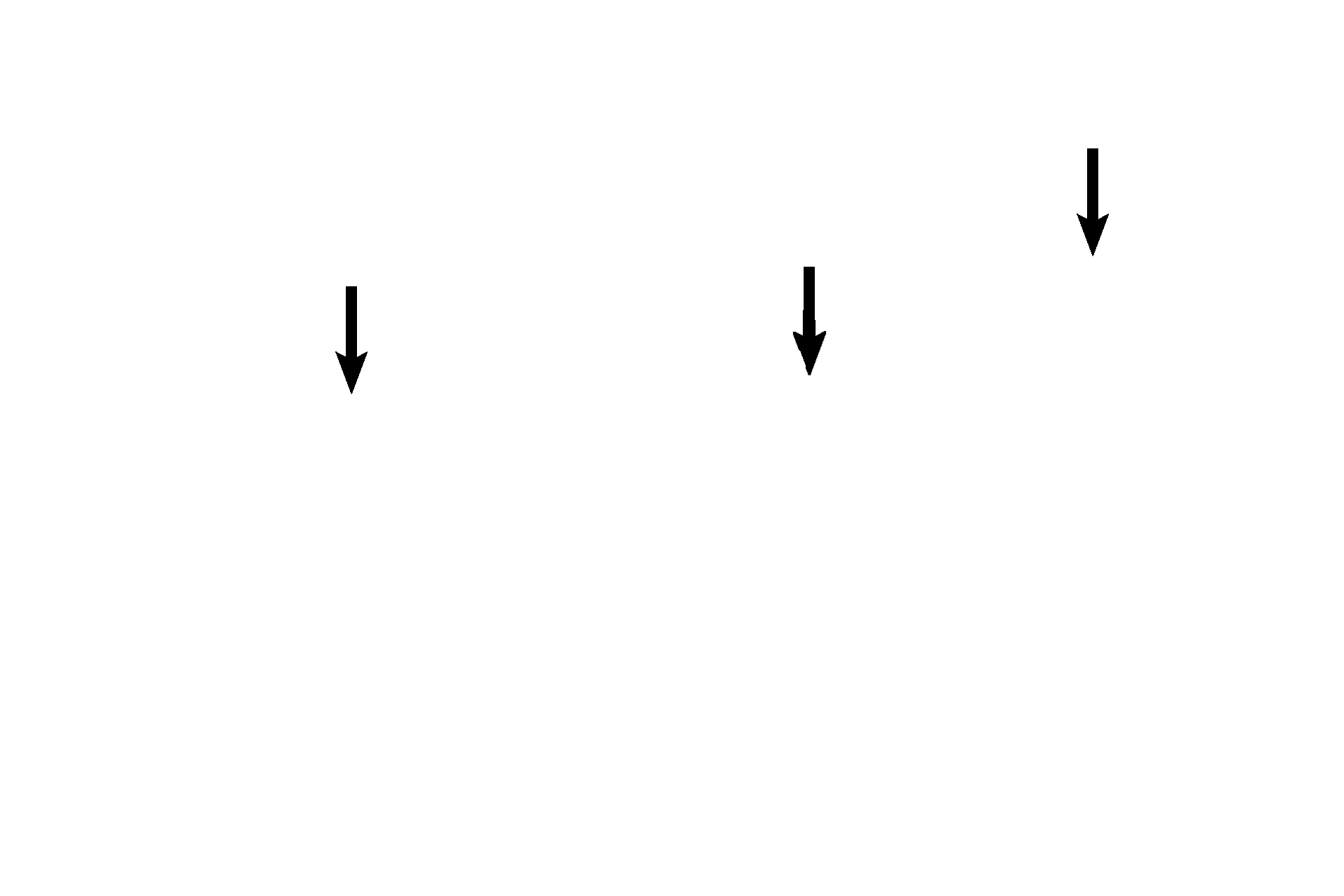 Elastic cartilage <p>Elastic cartilage is found where both support and great flexibility are required. Shown in this image, elastic cartilage forms the flexible framework in the pinna of the external ear that readily bends but rebounds to its original state. Elastic cartilage also forms the framework for the epiglottis and several of the smaller laryngeal cartilages. Elastic cartilage, like hyaline cartilage, has a surrounding perichondrium. 10x</p>
