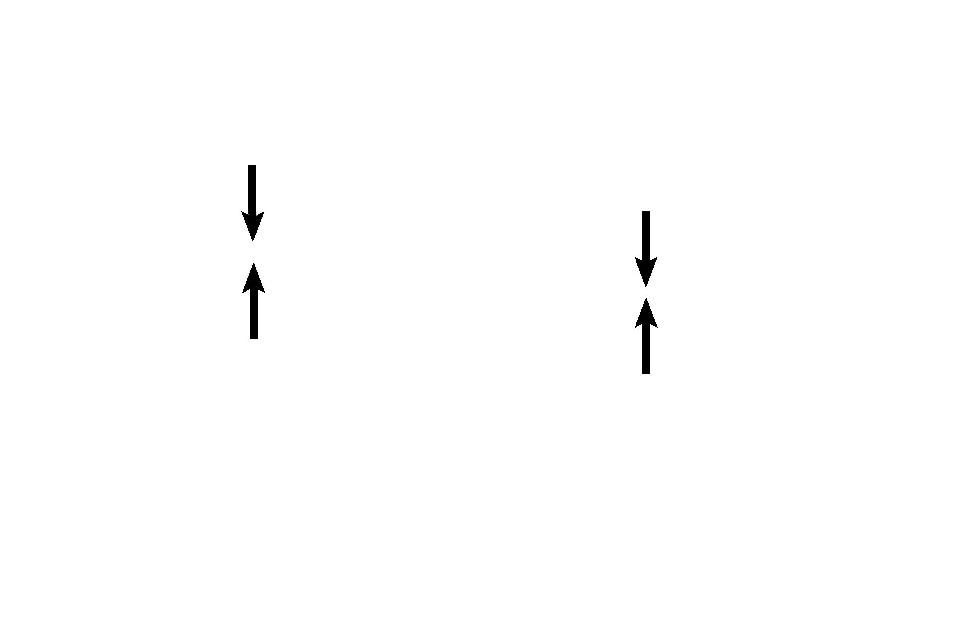 Perichondrium <p>Elastic cartilage is found where both support and great flexibility are required. Shown in this image, elastic cartilage forms the flexible framework in the pinna of the external ear that readily bends but rebounds to its original state. Elastic cartilage also forms the framework for the epiglottis and several of the smaller laryngeal cartilages. Elastic cartilage, like hyaline cartilage, has a surrounding perichondrium. 10x</p>
