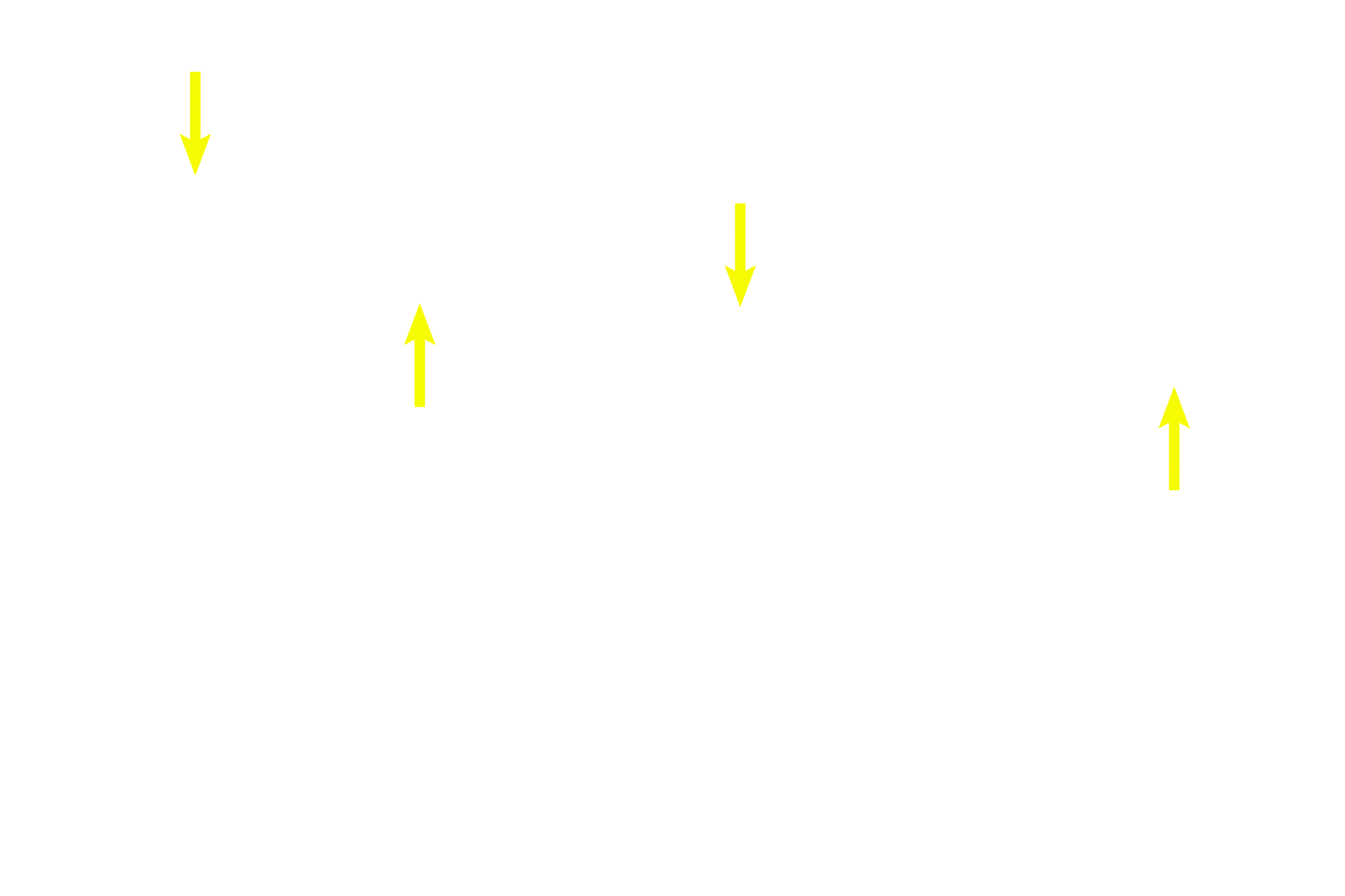 Chondrocytes <p>Chondrocytes in elastic cartilage are larger and more numerous than in hyaline cartilage and form fewer isogenous groups. The extracellular matrix of elastic cartilage is less abundant than in hyaline cartilage. This special stain demonstrates the abundant elastic fibers in the matrix.  Masson stain 100x</p>
