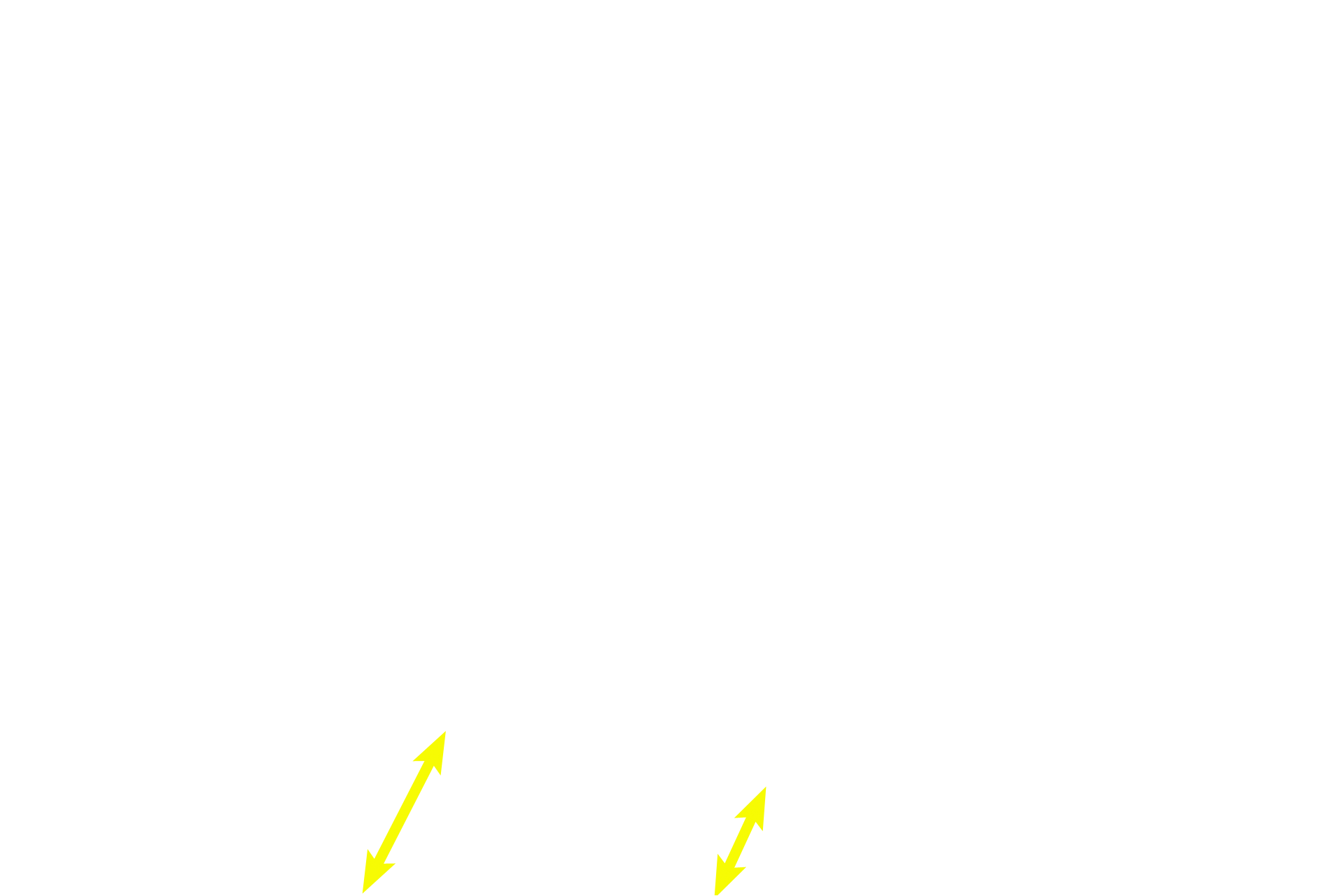 Perichondrium > <p>A perichondrium surrounds elastic cartilage and consists of an outer portion, the fibrous layer, and an inner chondrogenic layer.</p>
