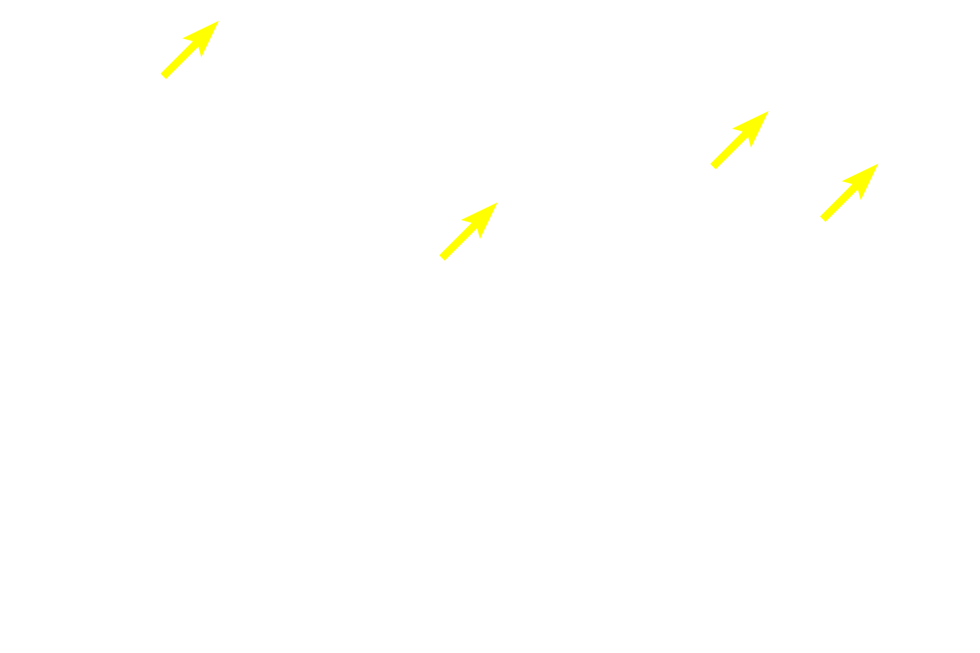  - Chondrocytes <p>Multipotential cells in the fibrous layer of the perichondrium differentiate into chondroblasts in the chondrogenic layer. When a chondroblast has surrounded itself with cartilage, it is then called a chondrocyte. A cluster of chondrocytes cloned from a single chondrocyte is an isogenous group, representing interstitial growth of this tissue. Cartilage is avascular and thus chondrocytes are nourished by diffusion. 400x</p>
