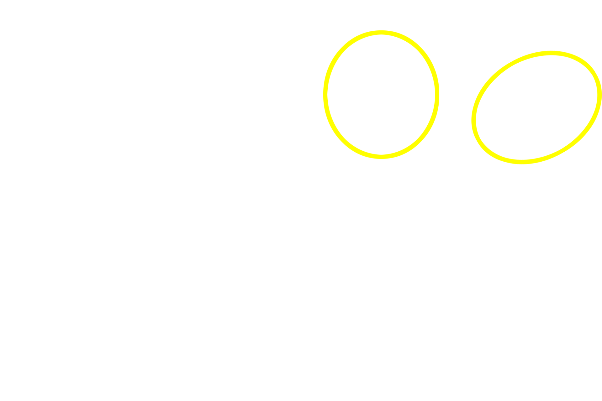  - Isogenous groups <p>Multipotential cells in the fibrous layer of the perichondrium differentiate into chondroblasts in the chondrogenic layer. When a chondroblast has surrounded itself with cartilage, it is then called a chondrocyte. A cluster of chondrocytes cloned from a single chondrocyte is an isogenous group, representing interstitial growth of this tissue. Cartilage is avascular and thus chondrocytes are nourished by diffusion. 400x</p>

