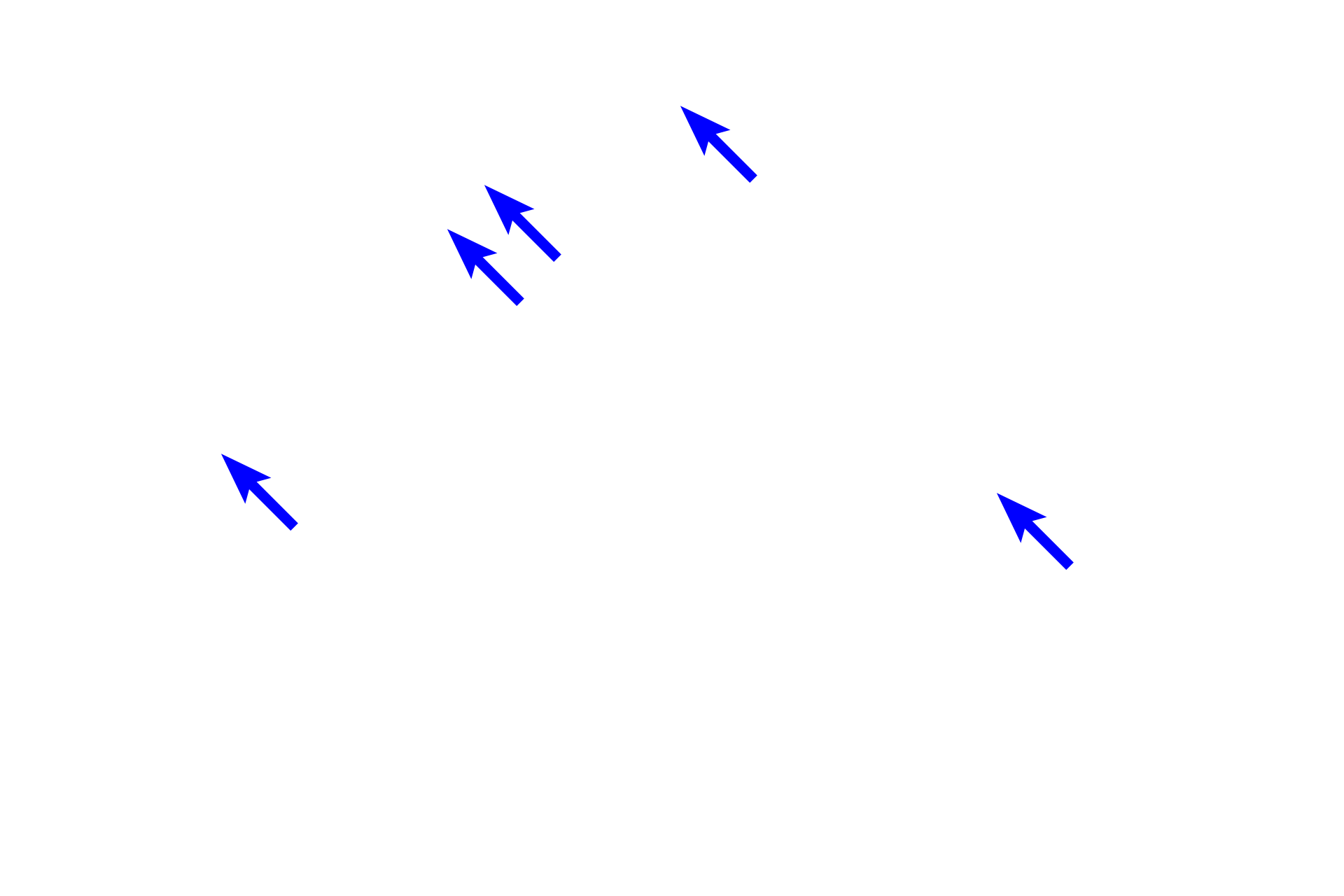 Lipid droplets <p>Adipocytes in brown adipose tissue contain numerous, small lipid droplets (multilocular) in their cytoplasm along with abundant mitochondria. The extraction of the lipid during tissue processing produces a frothy appearance to the cytoplasm. Brown adipose tissue is so-called because the abundant mitochondria with their large amounts of cytochrome oxidase, impart a brown color to the cells. Also adding to the color is the rich vascular supply.</p>

