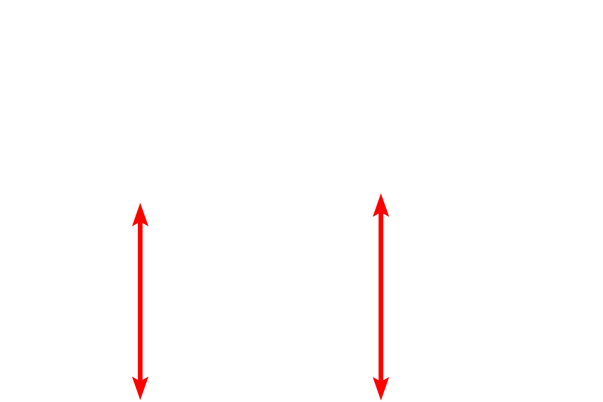 Basement membrane <p>This electron micrograph shows the basement membrane with its two components, the basal lamina and the reticular lamina. The basal lamina is, in turn, subdivided into the lamina lucida and the lamina densa.  The reticular lamina lies beneath the basal lamina and is composed of loose connective tissue with type III collagen fibrils.  Anchoring fibrils extend from the lamina densa and loop around the type III collagen fibrils serving to attach the basal lamina to the underlying loose connective tissue of the reticular lamina. Capillary 45,000x.</p>
