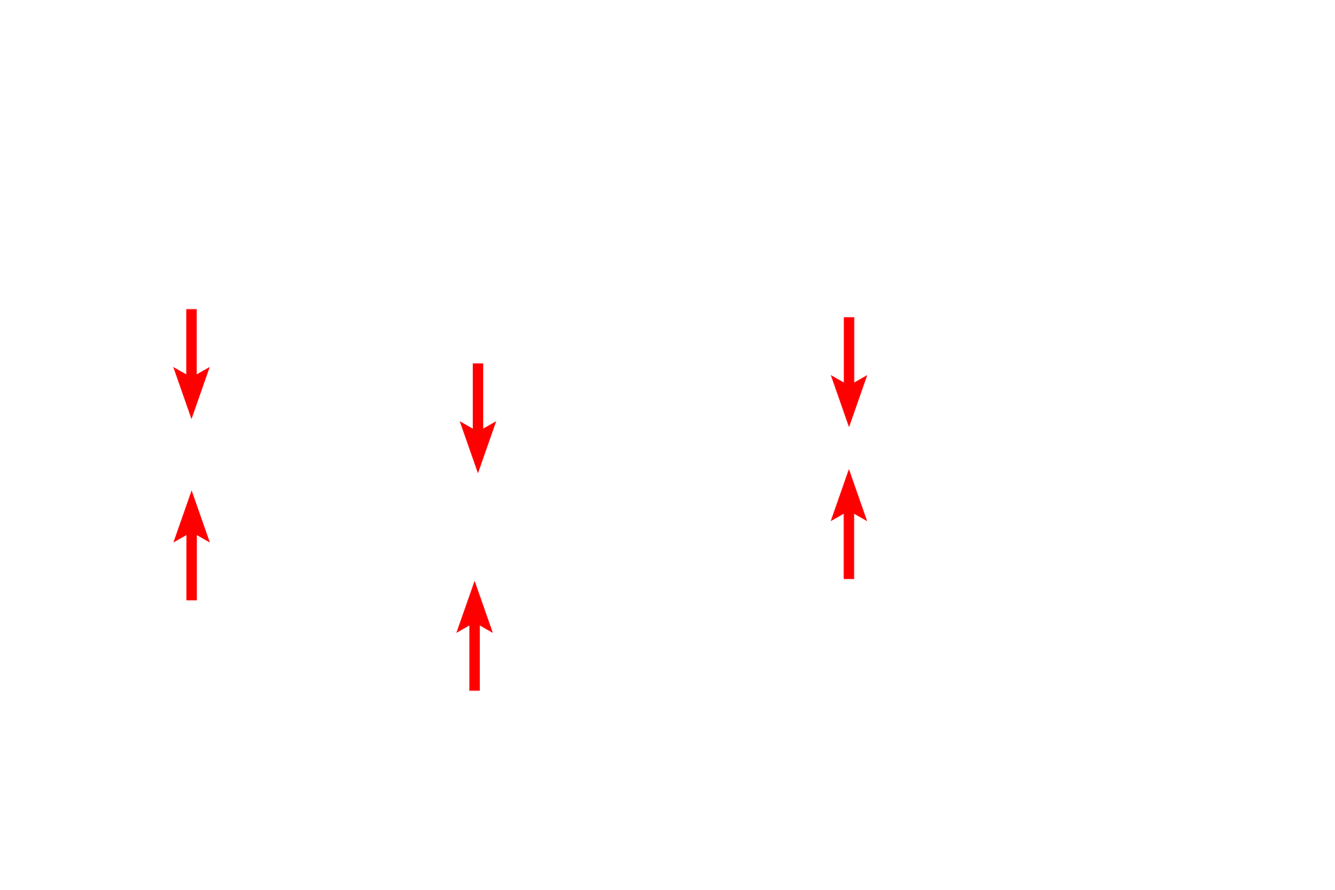  - Basal lamina <p>This electron micrograph shows the basement membrane with its two components, the basal lamina and the reticular lamina. The basal lamina is, in turn, subdivided into the lamina lucida and the lamina densa.  The reticular lamina lies beneath the basal lamina and is composed of loose connective tissue with type III collagen fibrils.  Anchoring fibrils extend from the lamina densa and loop around the type III collagen fibrils serving to attach the basal lamina to the underlying loose connective tissue of the reticular lamina. Capillary 45,000x.</p>
