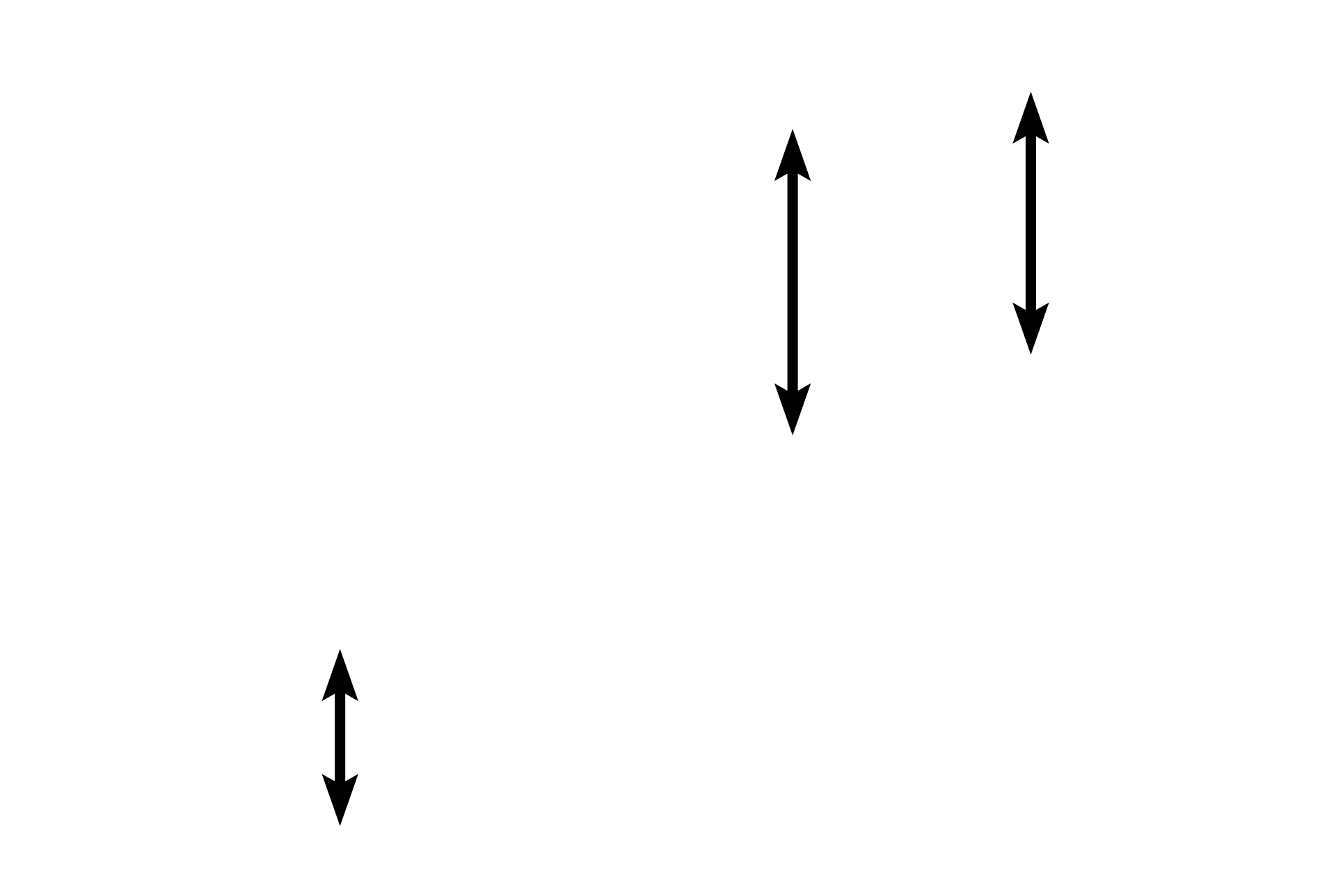 Purkinje fibers <p>Purkinje fibers are modified cardiac muscle cells.  They are larger than ventricular muscle cells and they have one or two round nuclei.  Additionally, myofibrils are sparse and restricted to the periphery of the cells.  The cytoplasm is rich in mitochondria and glycogen; the glycogen-rich center portion of the cell stains palely with hematoxylin and eosin.  After traveling in the subendocardium, Purkinje fibers penetrate the ventricular myocardium to innervate cardiac muscle fibers.  1000x</p>
