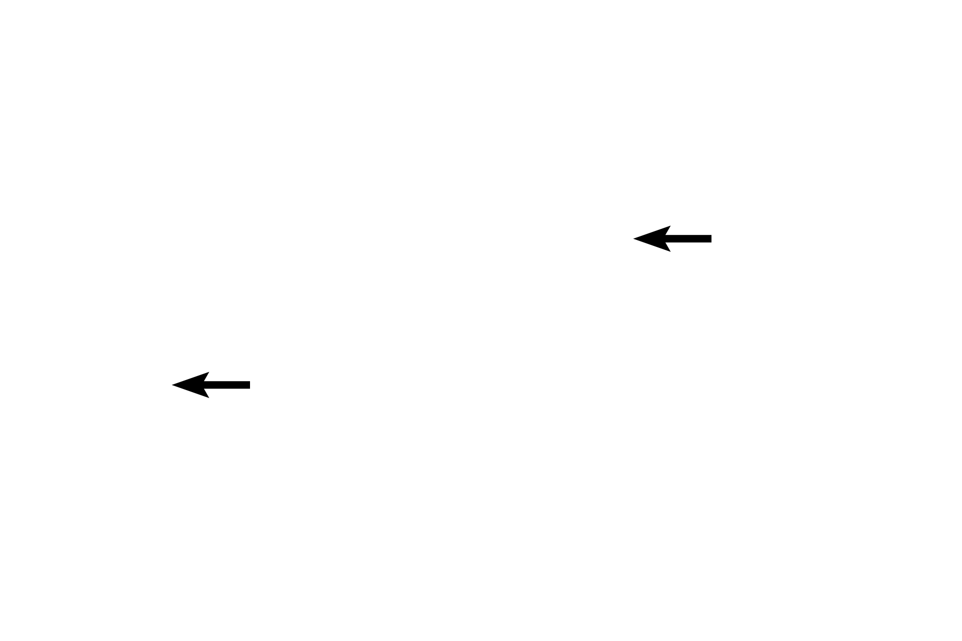 Nuclei <p>Purkinje fibers are modified cardiac muscle cells.  They are larger than ventricular muscle cells and they have one or two round nuclei.  Additionally, myofibrils are sparse and restricted to the periphery of the cells.  The cytoplasm is rich in mitochondria and glycogen; the glycogen-rich center portion of the cell stains palely with hematoxylin and eosin.  After traveling in the subendocardium, Purkinje fibers penetrate the ventricular myocardium to innervate cardiac muscle fibers.  1000x</p>
