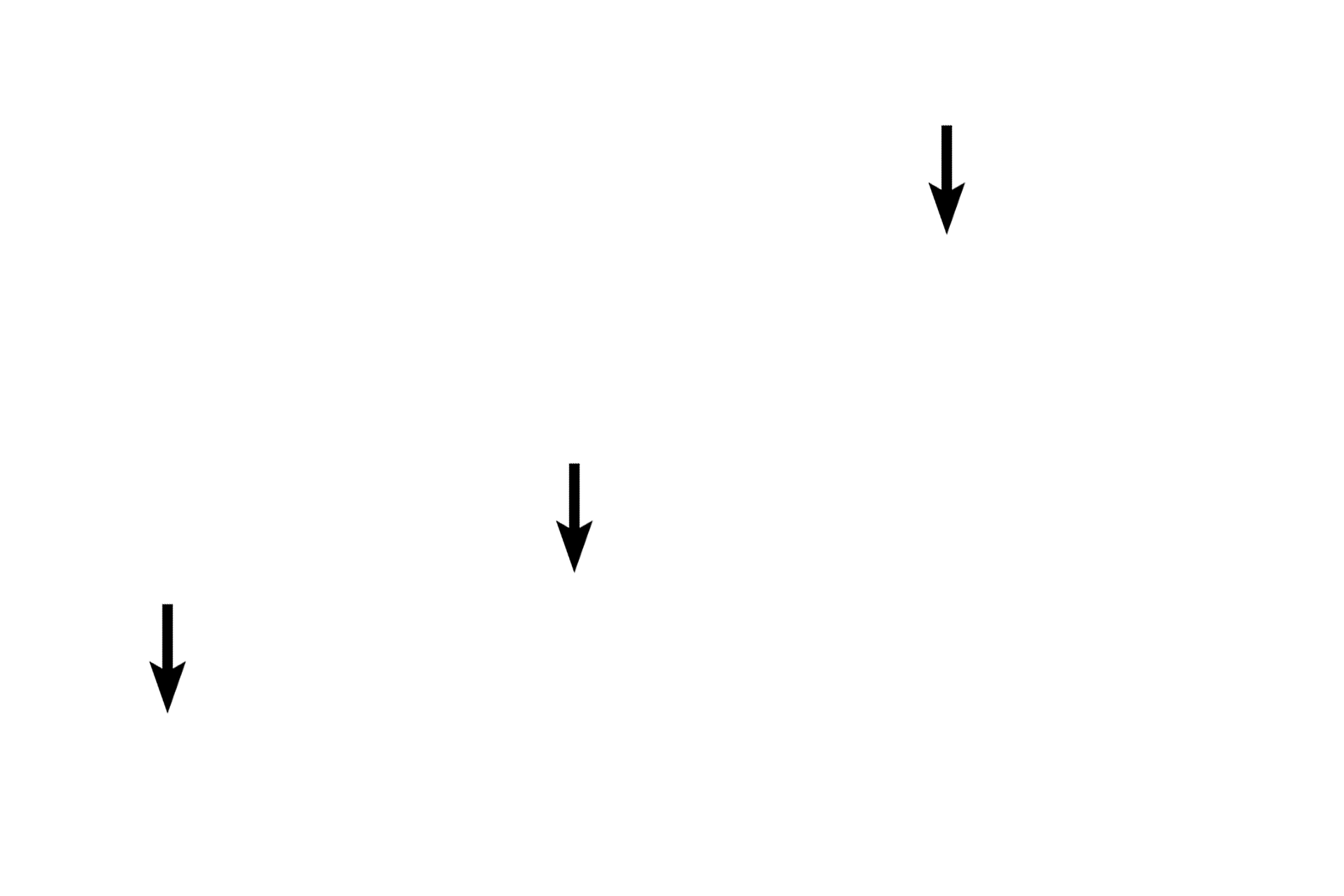 Myofibrils <p>Purkinje fibers are modified cardiac muscle cells.  They are larger than ventricular muscle cells and they have one or two round nuclei.  Additionally, myofibrils are sparse and restricted to the periphery of the cells.  The cytoplasm is rich in mitochondria and glycogen; the glycogen-rich center portion of the cell stains palely with hematoxylin and eosin.  After traveling in the subendocardium, Purkinje fibers penetrate the ventricular myocardium to innervate cardiac muscle fibers.  1000x</p>
