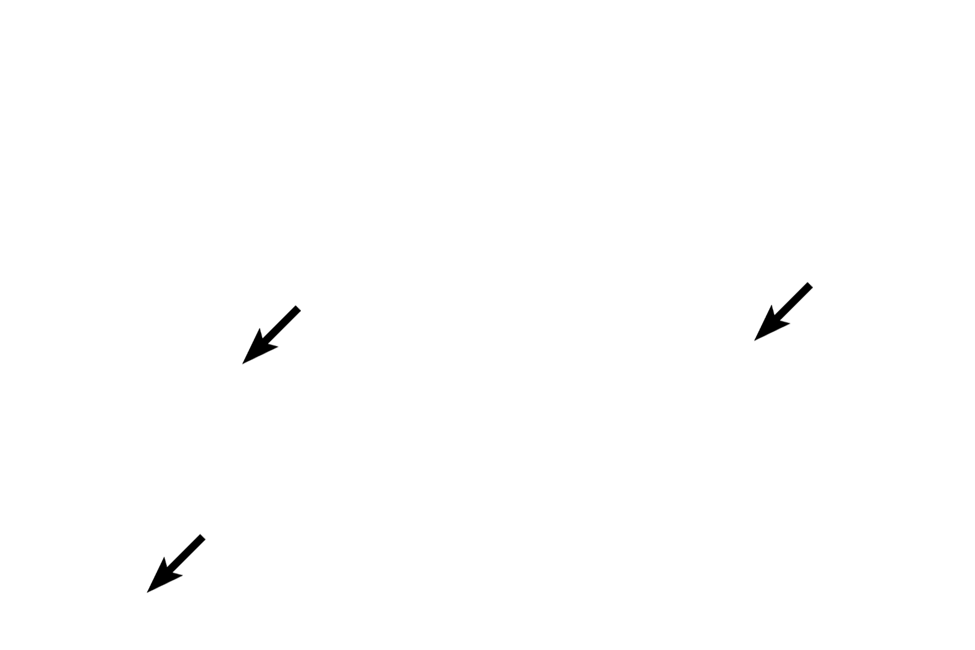 Glycogen <p>Purkinje fibers are modified cardiac muscle cells.  They are larger than ventricular muscle cells and they have one or two round nuclei.  Additionally, myofibrils are sparse and restricted to the periphery of the cells.  The cytoplasm is rich in mitochondria and glycogen; the glycogen-rich center portion of the cell stains palely with hematoxylin and eosin.  After traveling in the subendocardium, Purkinje fibers penetrate the ventricular myocardium to innervate cardiac muscle fibers.  1000x</p>
