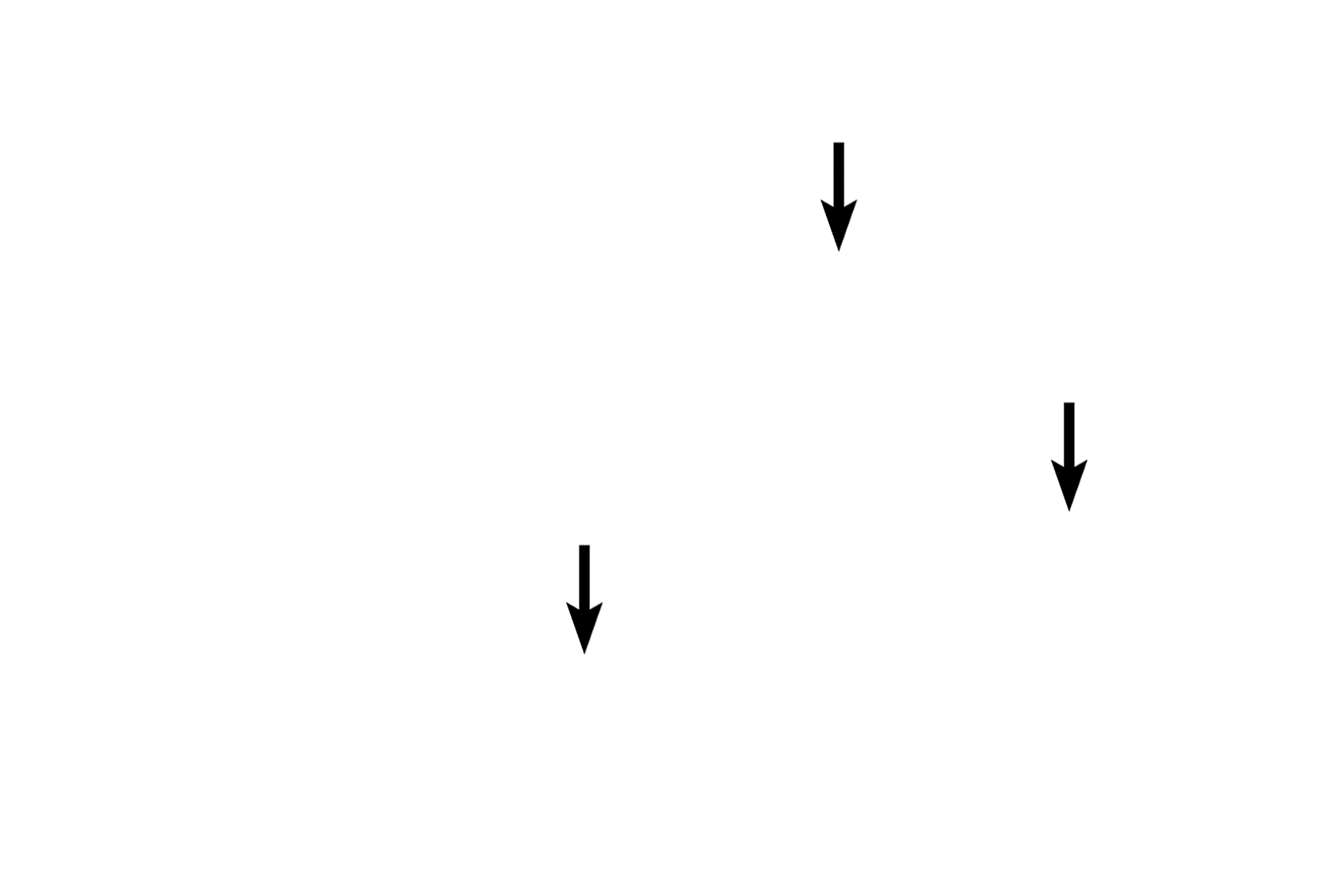 Mitochondria <p>Purkinje fibers are modified cardiac muscle cells.  They are larger than ventricular muscle cells and they have one or two round nuclei.  Additionally, myofibrils are sparse and restricted to the periphery of the cells.  The cytoplasm is rich in mitochondria and glycogen; the glycogen-rich center portion of the cell stains palely with hematoxylin and eosin.  After traveling in the subendocardium, Purkinje fibers penetrate the ventricular myocardium to innervate cardiac muscle fibers.  1000x</p>
