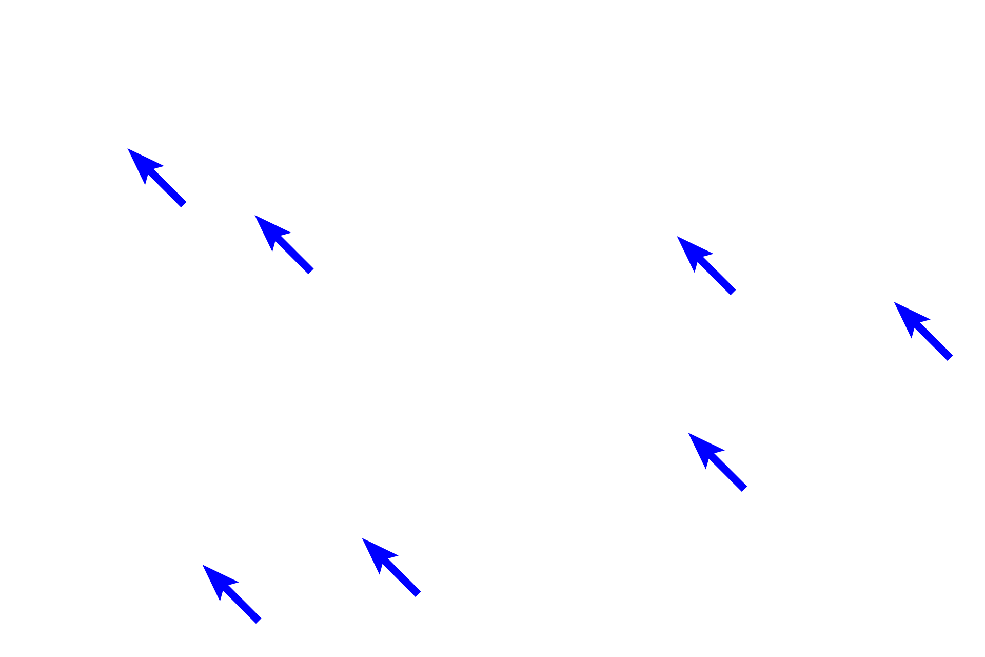  - Beta cells <p>These images show two special histochemical stains used to distinguish among the different cell types in the islet of Langerhans.  The aldehyde fuchsin method (left) stains insulin-secreting beta cells blue.  The Gomori’s method (right) stains insulin-secreting beta cells light blue and glucagon-secreting alpha cells pink.  Beta cells comprise about 70% of the islet cells, alpha cells about 20%.  The remaining somtatostatin-secreting delta cells are not distinguished by these methods.  400x, 400x</p>
