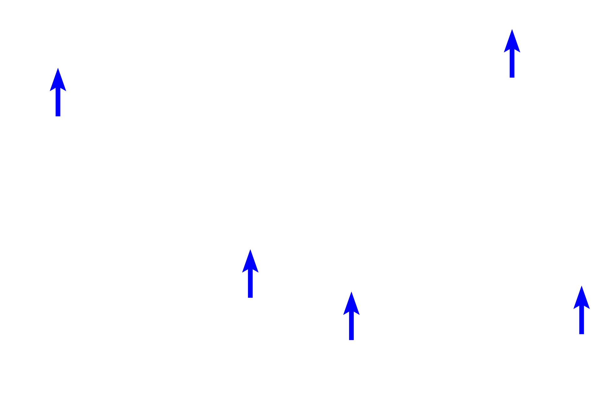 Acini <p>These images show two special histochemical stains used to distinguish among the different cell types in the islet of Langerhans.  The aldehyde fuchsin method (left) stains insulin-secreting beta cells blue.  The Gomori’s method (right) stains insulin-secreting beta cells light blue and glucagon-secreting alpha cells pink.  Beta cells comprise about 70% of the islet cells, alpha cells about 20%.  The remaining somtatostatin-secreting delta cells are not distinguished by these methods.  400x, 400x</p>

