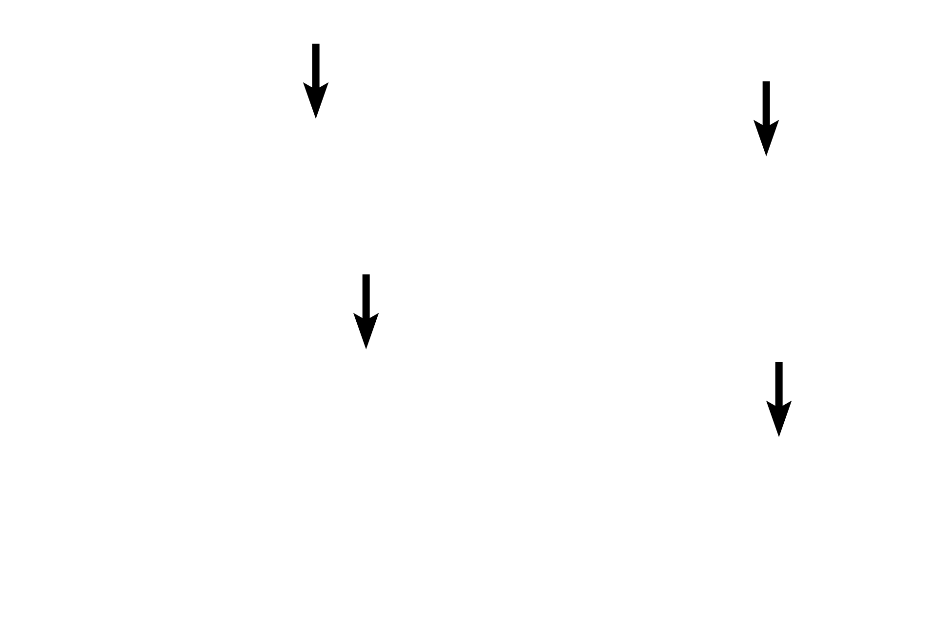 Muscle fibers <p>Cardiac muscle fibers are unique in that they branch and interlace. This hematoxylin and eosin stained, longitudinal section shows cardiac muscle fibers forming a feltwork in the myocardium of the heart. Cardiac muscle fibers are striated, though the cross striations are not as prominent as in skeletal muscle fibers. 400x</p>
