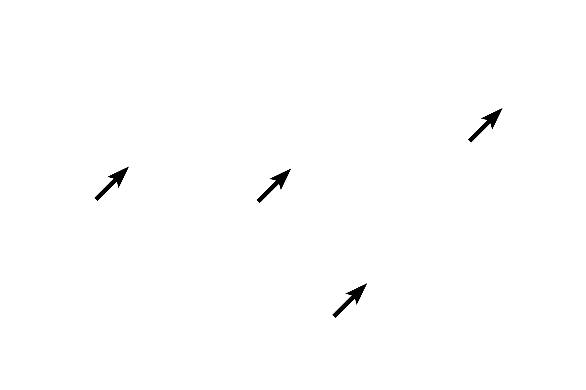 Nuclei <p>Cardiac muscle fibers are unique in that they branch and interlace. This hematoxylin and eosin stained, longitudinal section shows cardiac muscle fibers forming a feltwork in the myocardium of the heart. Cardiac muscle fibers are striated, though the cross striations are not as prominent as in skeletal muscle fibers. 400x</p>
