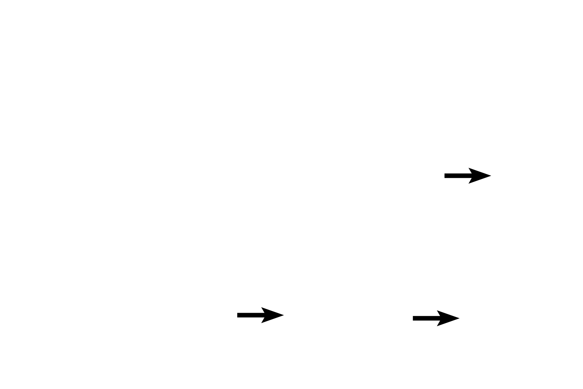 Striations <p>Cardiac muscle fibers are unique in that they branch and interlace. This hematoxylin and eosin stained, longitudinal section shows cardiac muscle fibers forming a feltwork in the myocardium of the heart. Cardiac muscle fibers are striated, though the cross striations are not as prominent as in skeletal muscle fibers. 400x</p>
