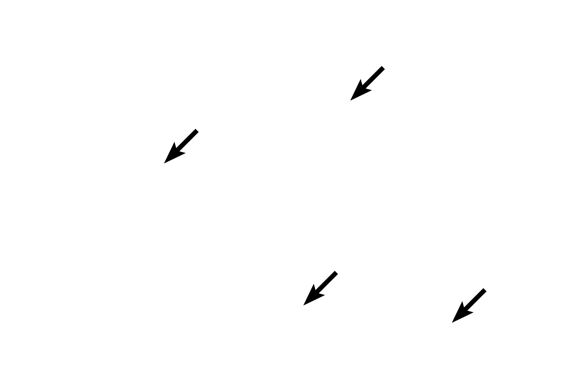 Intercalated discs <p>Cardiac muscle fibers are unique in that they branch and interlace. This hematoxylin and eosin stained, longitudinal section shows cardiac muscle fibers forming a feltwork in the myocardium of the heart. Cardiac muscle fibers are striated, though the cross striations are not as prominent as in skeletal muscle fibers. 400x</p>
