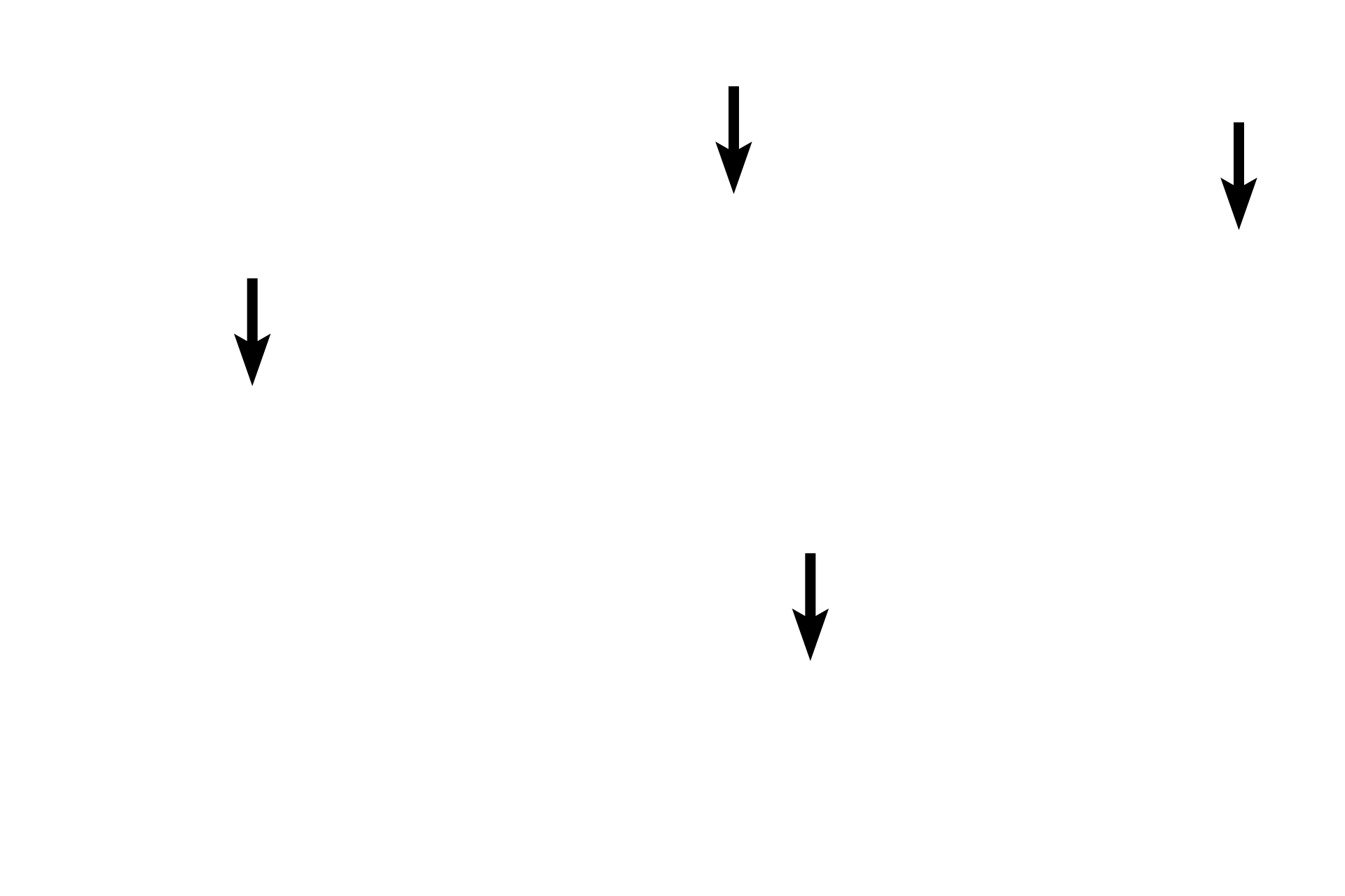 Lipofuscin pigment > <p>Lipofuscin is a pigment residue of lysosomal digestion and appears as fine, membrane-bound yellowish-brown granules in the cytoplasm. Lipofuscin is composed of oxidized lipids and proteins that accumulate in cells during normal aging. Lipofuscin is particularly abundant in long-lived cells such as these muscle fibers and neurons.</p>
