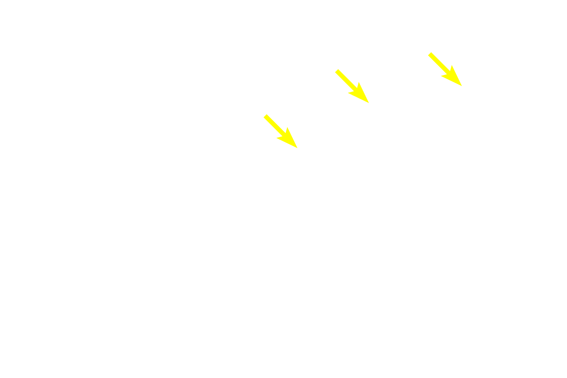 Sensory nerve endings <p>Muscle spindles, seen here in longitudinal (top) and cross sections (bottom), are encapsulated stretch receptors in skeletal muscles that regulate muscle contraction and detect changes in muscle length. Muscle spindles are composed of intrafusal fibers which are modified skeletal muscle fibers of two types, nuclear bag and nuclear chain fibers. Spiraling sensory nerve endings surround the nuclear bag fibers. Intrafusal fibers also receive efferent innervation. A fluid-filled space separates the internal capsule from an outer external capsule. 800x</p>
