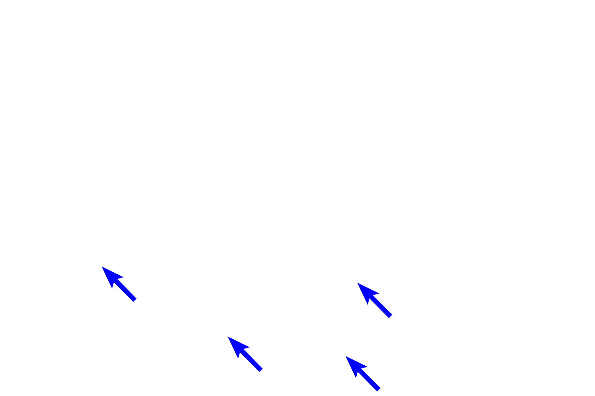 Inner capsule <p>Muscle spindles, seen here in longitudinal (top) and cross sections (bottom), are encapsulated stretch receptors in skeletal muscles that regulate muscle contraction and detect changes in muscle length. Muscle spindles are composed of intrafusal fibers which are modified skeletal muscle fibers of two types, nuclear bag and nuclear chain fibers. Spiraling sensory nerve endings surround the nuclear bag fibers. Intrafusal fibers also receive efferent innervation. A fluid-filled space separates the internal capsule from an outer external capsule. 800x</p>
