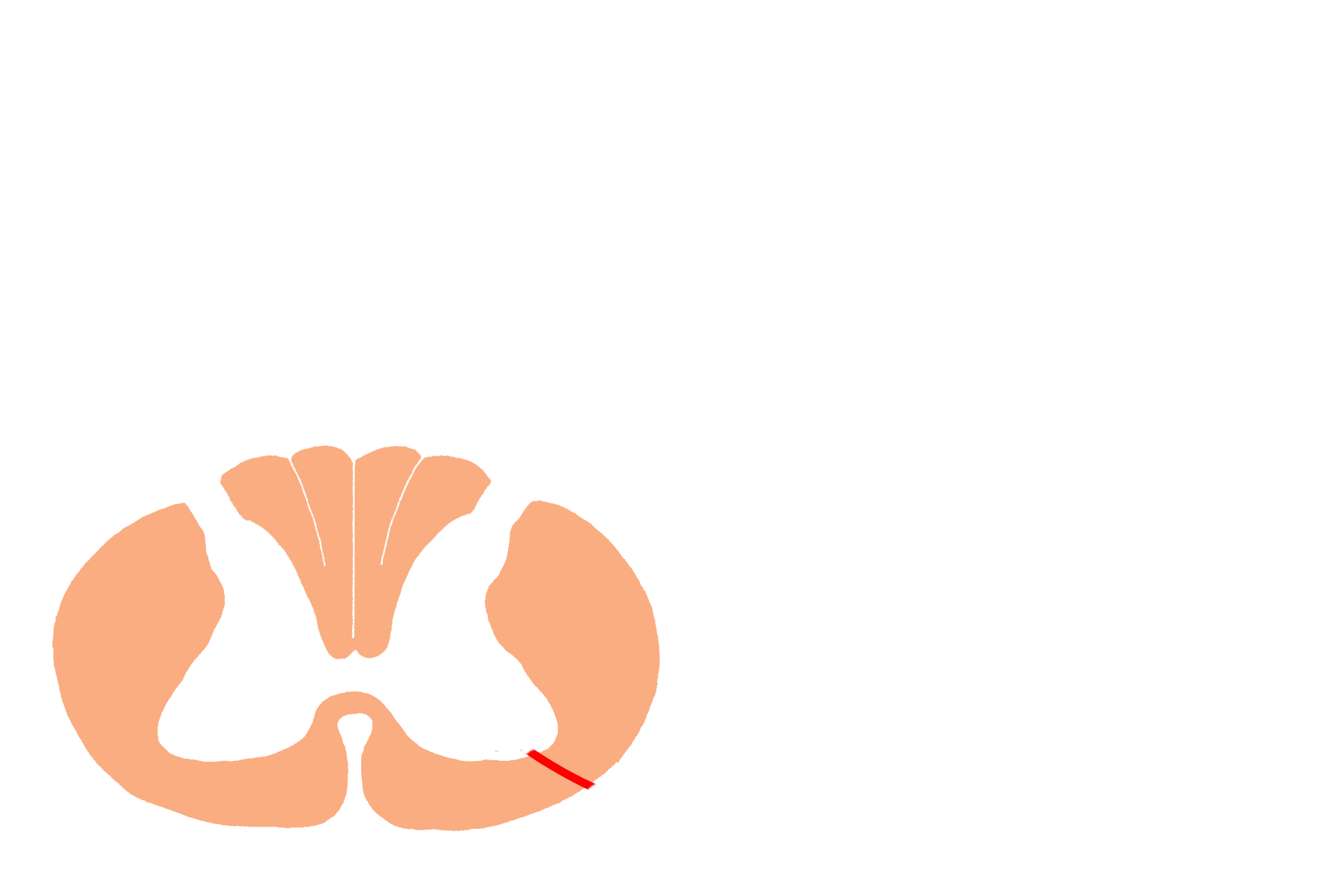 CNS: Brain and spinal cord > <p>The central nervous system (CNS) consists of the brain and spinal cord, seen here.  Both subdivisions have areas where nerve cell bodies are located (grey matter), and areas where axon tracts predominate (white matter).  The spinal cord has a central, H-shaped area of grey matter and a peripheral zone of white matter (shaded in orange), containing axons traveling to or from higher and lower CNS centers.</p>
