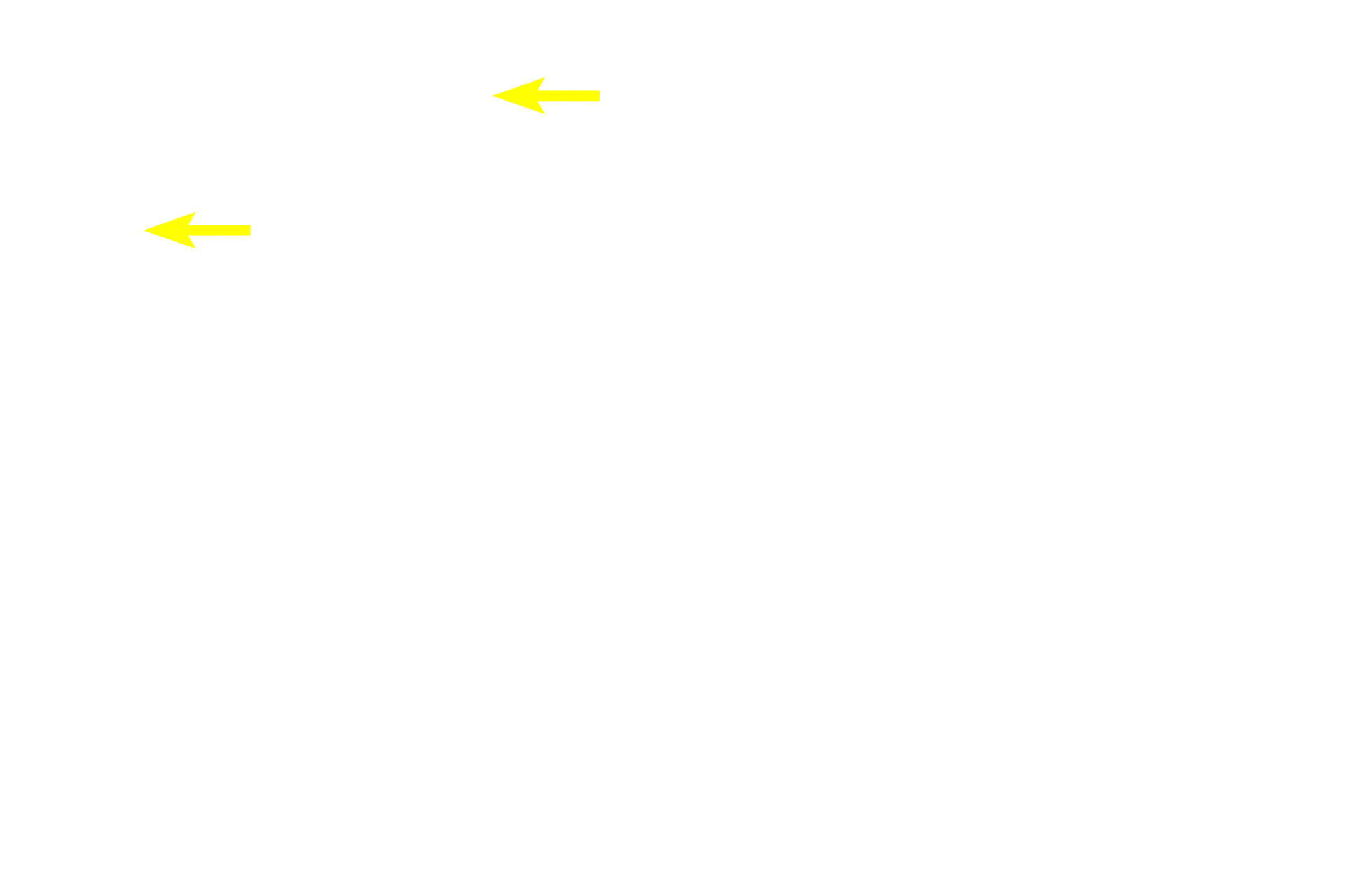  - Nerve fiber layer <p>Ganglion cells, located in the ganglion cell layer, synapse with bipolar cells and their cell bodies.  Axons from these cells travel in nerve fiber layer, passing toward the optic disc, where they exit as the optic nerve.</p>
