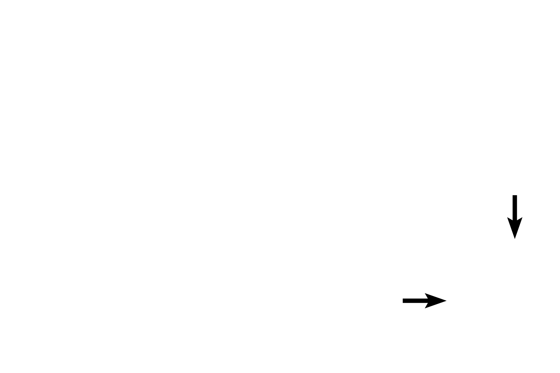 External elastic lamina <p>Arteries and veins of similar caliber often travel together along with nerves. They are surrounded by a connective tissue sheath forming a neurovascular bundle. In this image, compare the relative thicknesses of the tunica media (thicker in artery) and tunica adventitia (thicker in vein) in these medium-sized vessels. A valve is present in the vein and represents a modification of the tunica intima. These valves prevent the backflow of blood due to gravity. Valves are not present in arteries. 40x</p>
