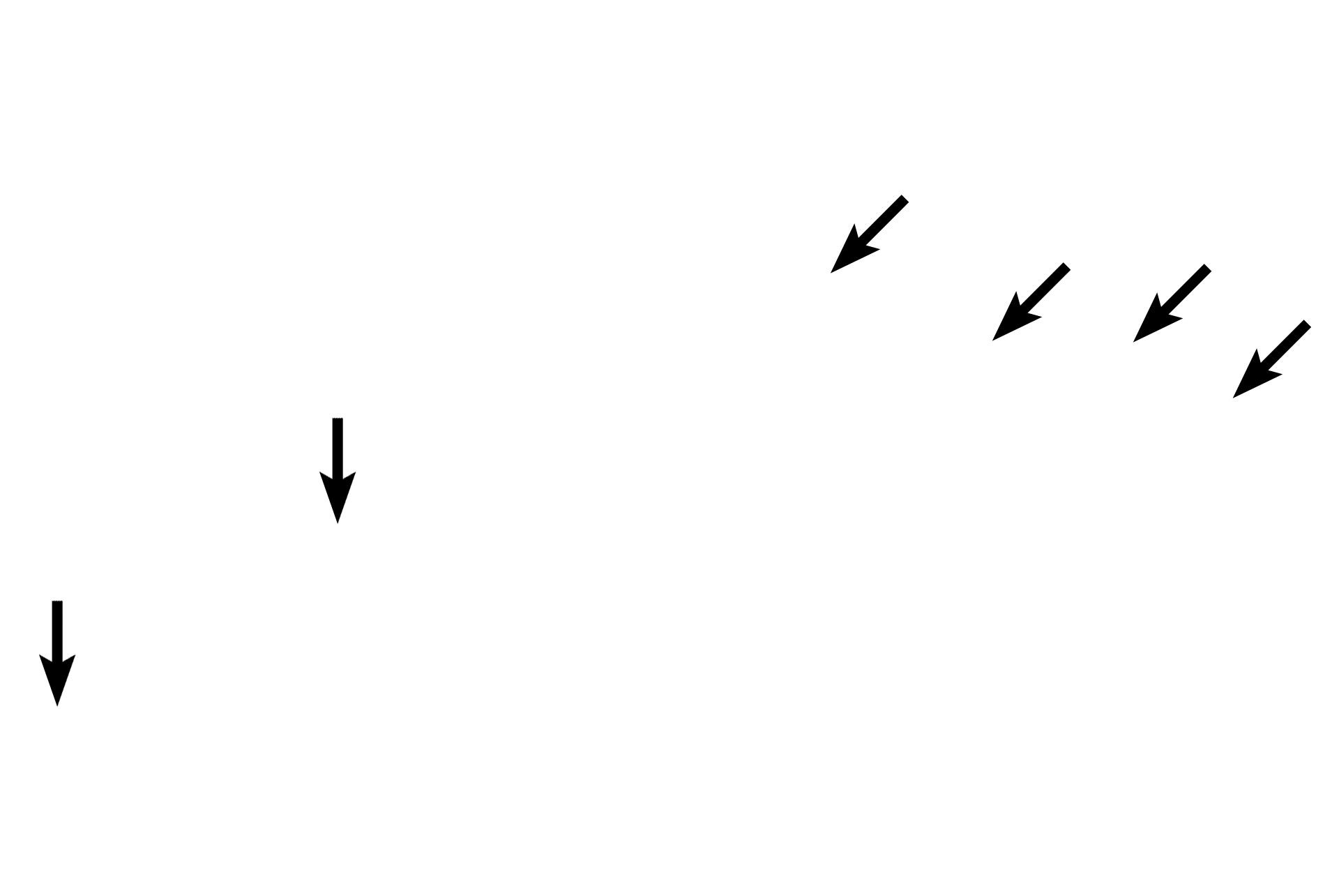 Squamous cell cytoplasm <p>With the light microscope, it is not always possible to distinguish the cell outline, however, the shape of the nucleus often predicts cell shape, since it conforms to the dimensions of the cell.  Squamous cells are often so flattened that the cytoplasm is reduced to a very thin layer.</p>
