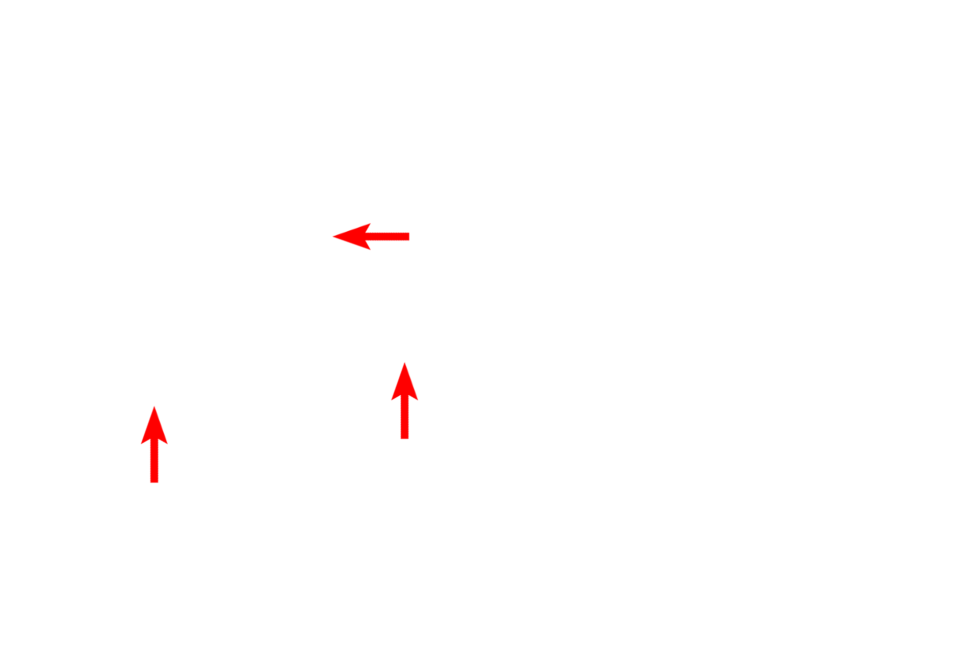 Dendrites <p>There are a number of variations in the use of silver as a stain, but each involves the precipitation of reduced silver onto tissue elements.  These images show silver staining of neurons (left) and reticular fibers (right).  Structures that stain with silver are referred to as argyrophilic. Cerebral cortex 1000x, Lymph node 1000x</p>
