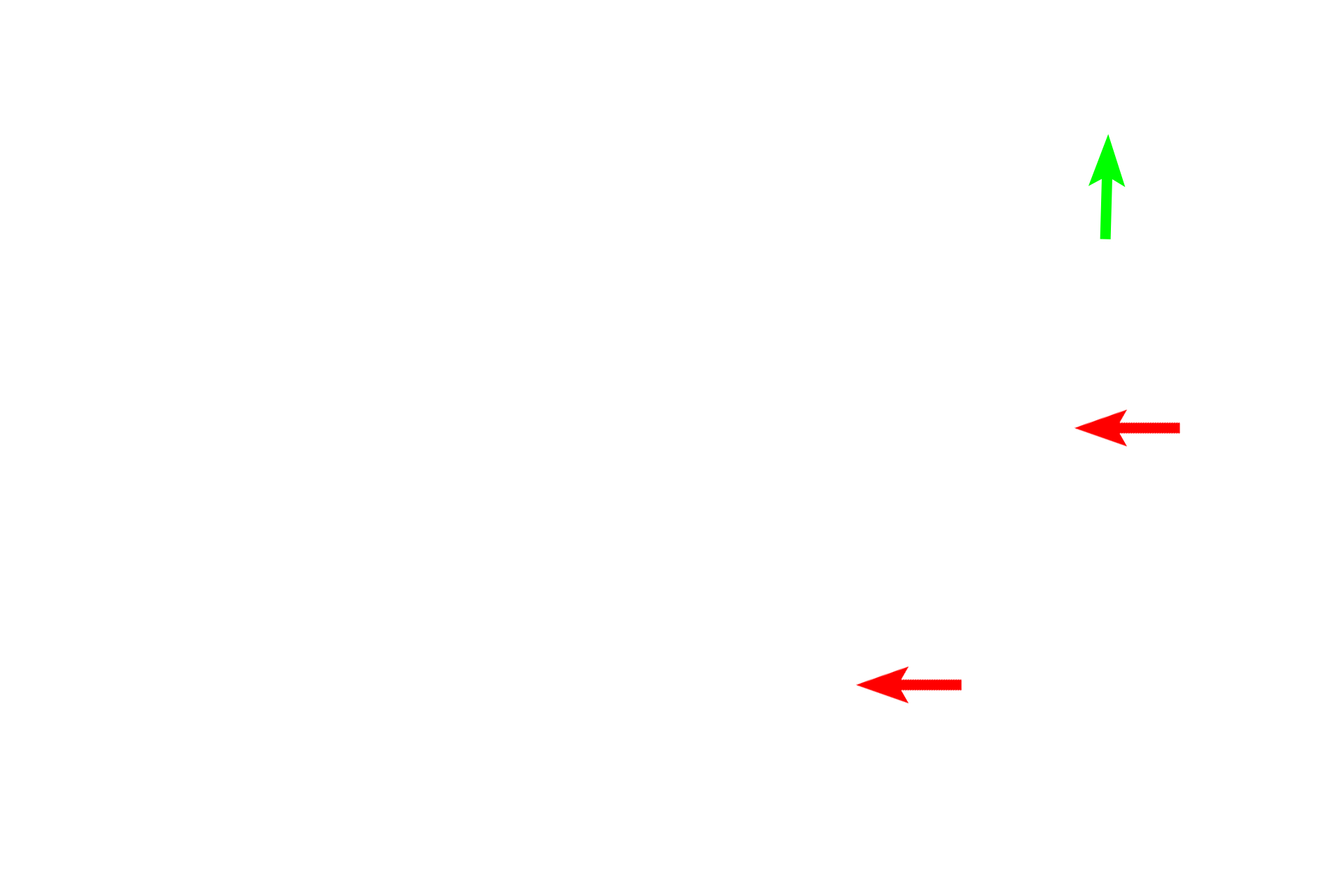 Reticular fibers > <p>Reticular fibers are a type of connective tissue fiber that stains with silver due their unique chemical composition.  Reticular fibers branch, providing the major support framework for lymphoid organs such as lymph node and spleen.  Reticular fibers also surround blood vessels (green arrow) as well as being widely distributed throughout connective tissue proper.</p>
