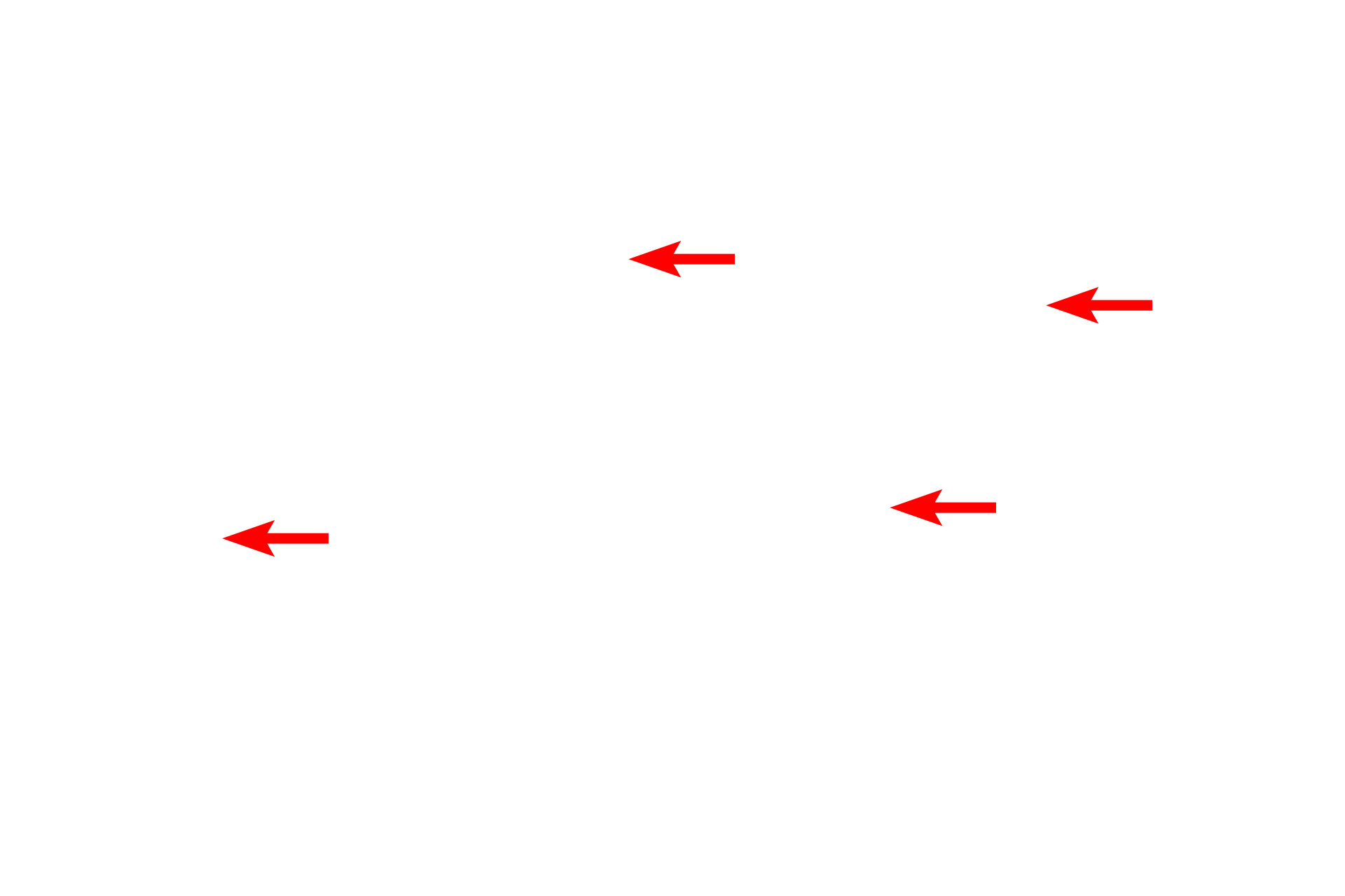 Nissl substance <p>Another example of the arrangement of protein synthetic structures is Nissl substance in neurons.  Nissl, containing RER and polysomes in large aggregations, is most prominent in large neurons.  The structure of the RER and ribosomes is not resolved with the light microscope.  1000x</p>

