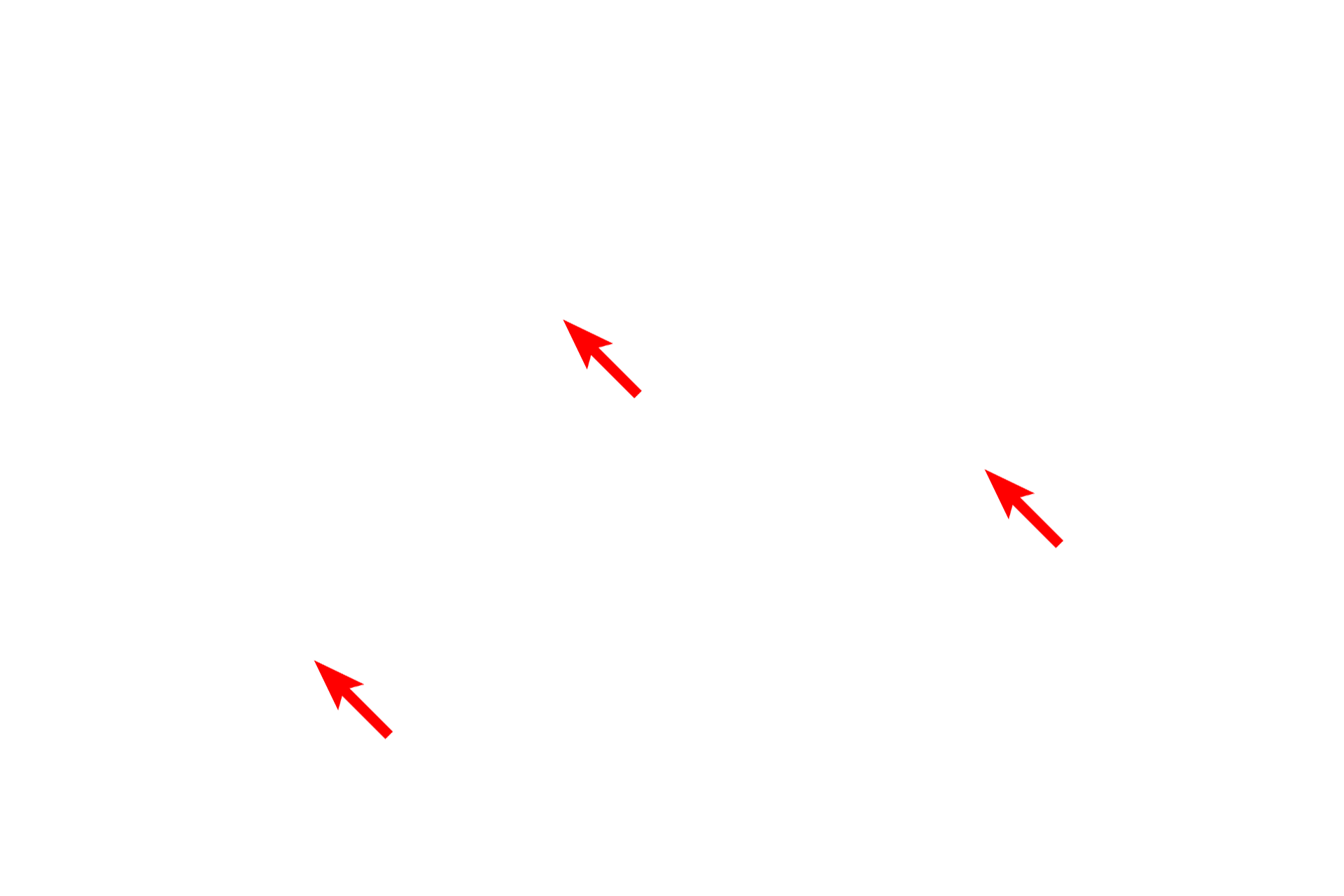 Nuclei <p>Another example of the arrangement of protein synthetic structures is Nissl substance in neurons.  Nissl, containing RER and polysomes in large aggregations, is most prominent in large neurons.  The structure of the RER and ribosomes is not resolved with the light microscope.  1000x</p>
