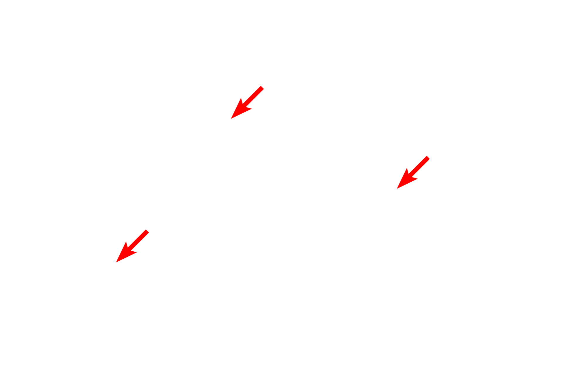  - Nucleoli <p>Another example of the arrangement of protein synthetic structures is Nissl substance in neurons.  Nissl, containing RER and polysomes in large aggregations, is most prominent in large neurons.  The structure of the RER and ribosomes is not resolved with the light microscope.  1000x</p>
